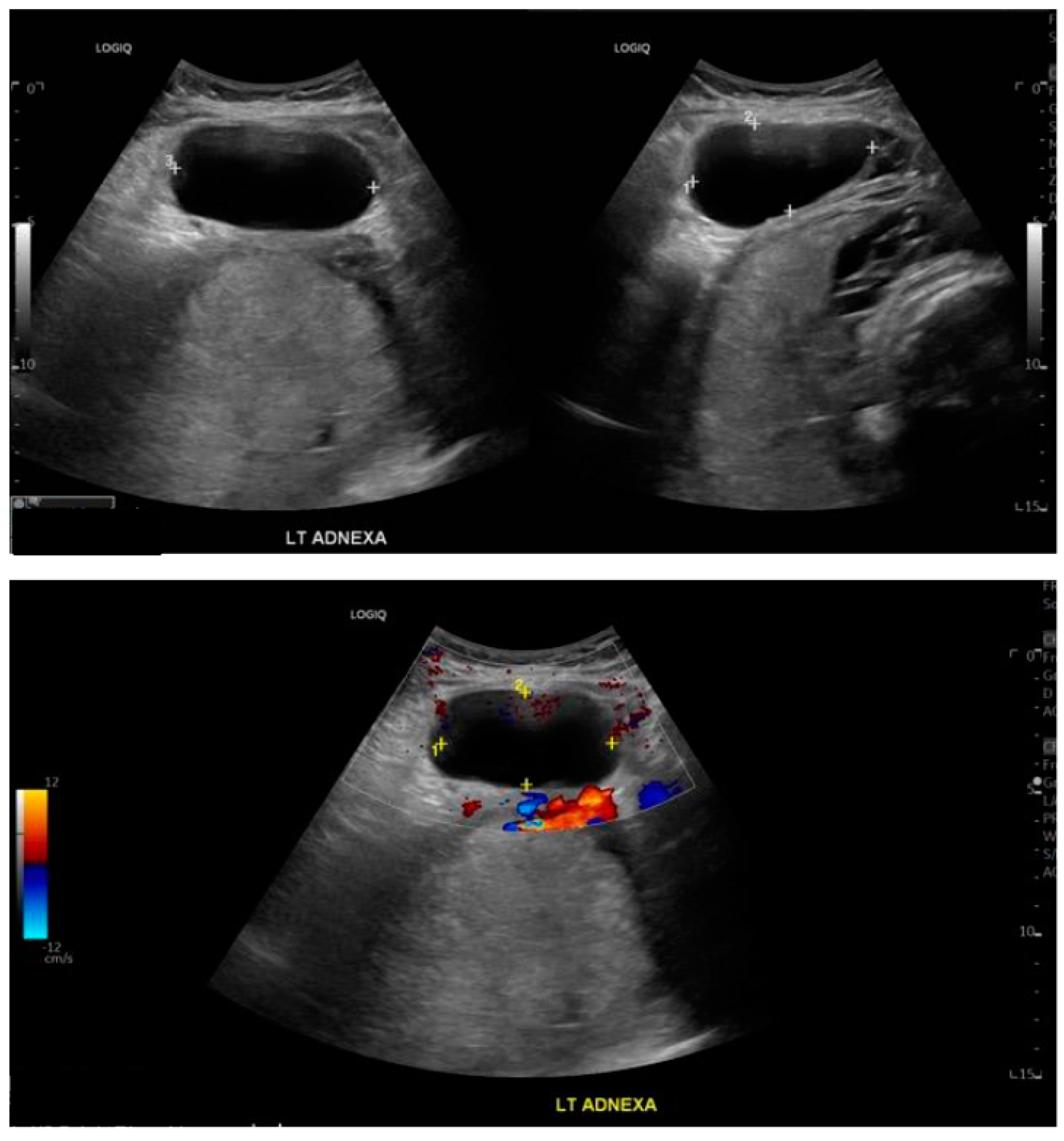 Medicina 60 01471 g003