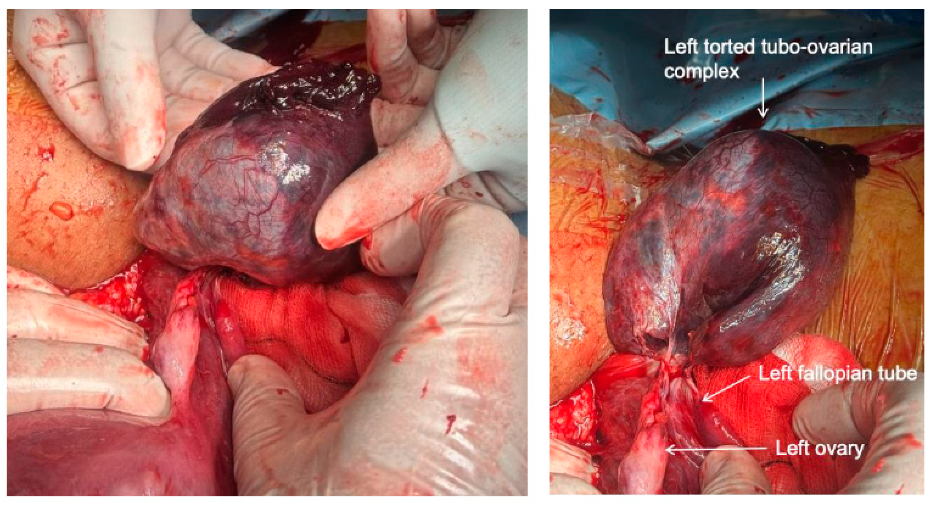 Medicina 60 01471 g004