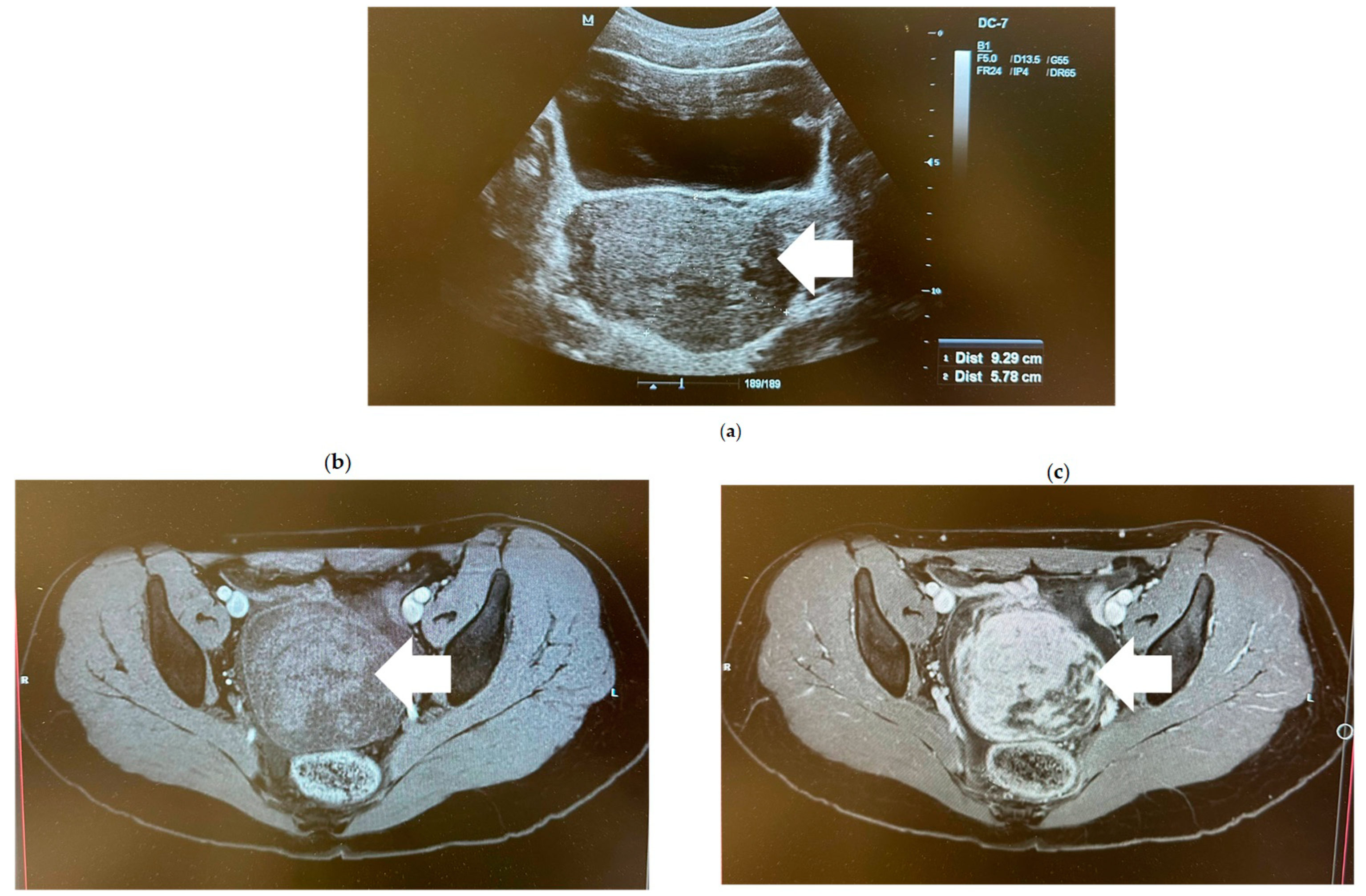 Medicina 60 01477 g001