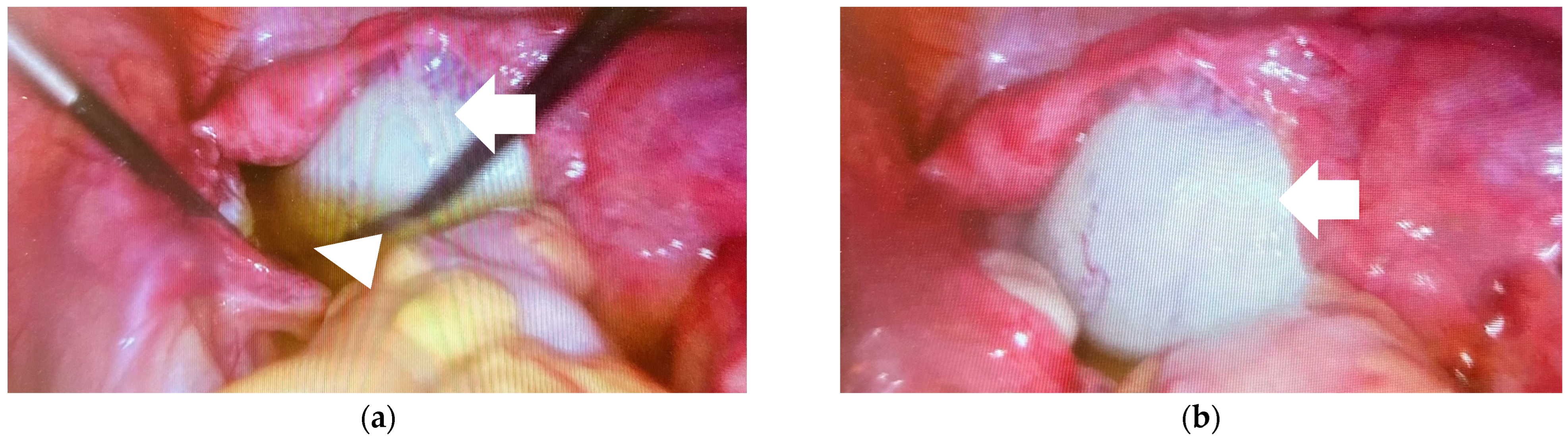 Medicina 60 01477 g002