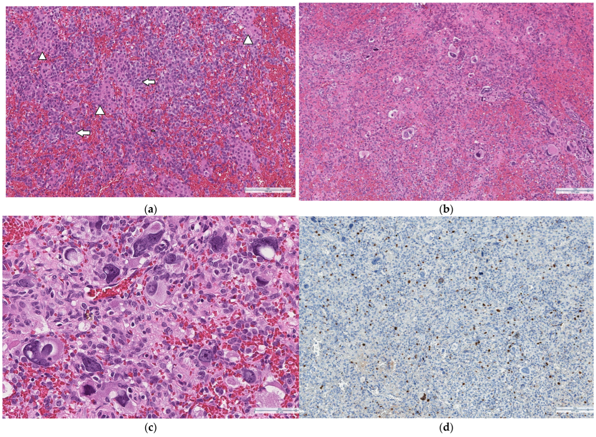 Medicina 60 01477 g003a