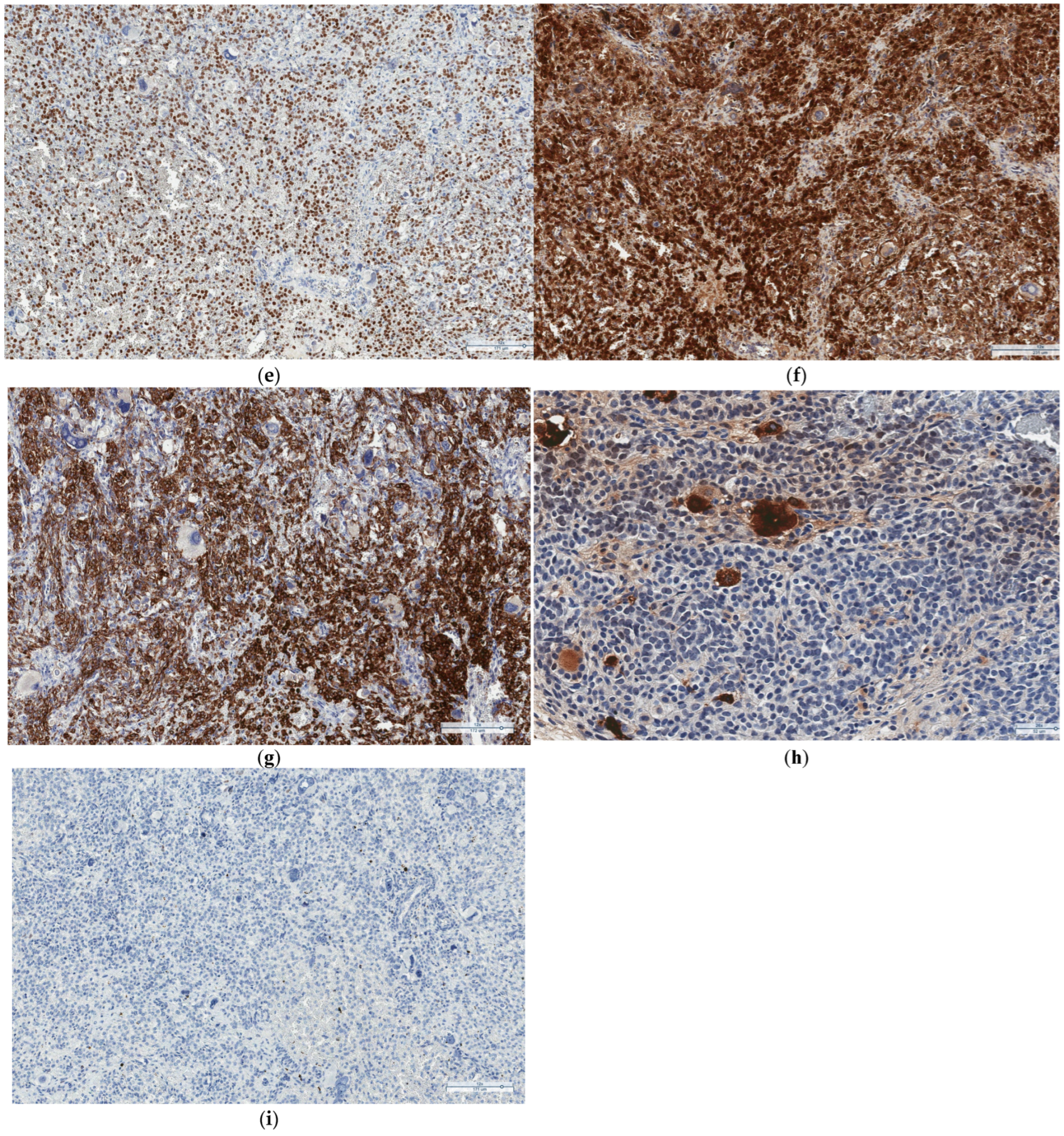 Medicina 60 01477 g003b