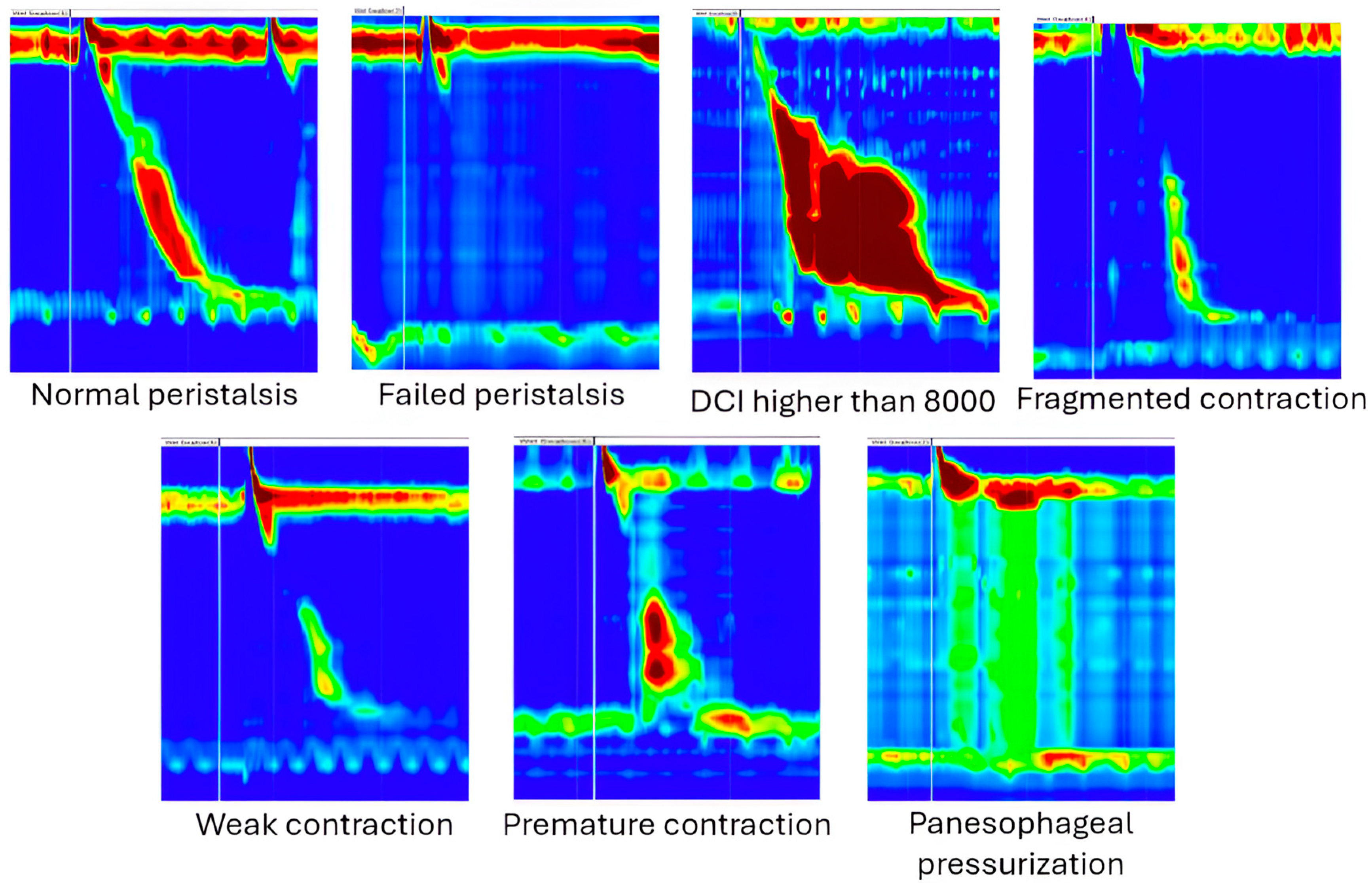 Medicina 60 01493 g001