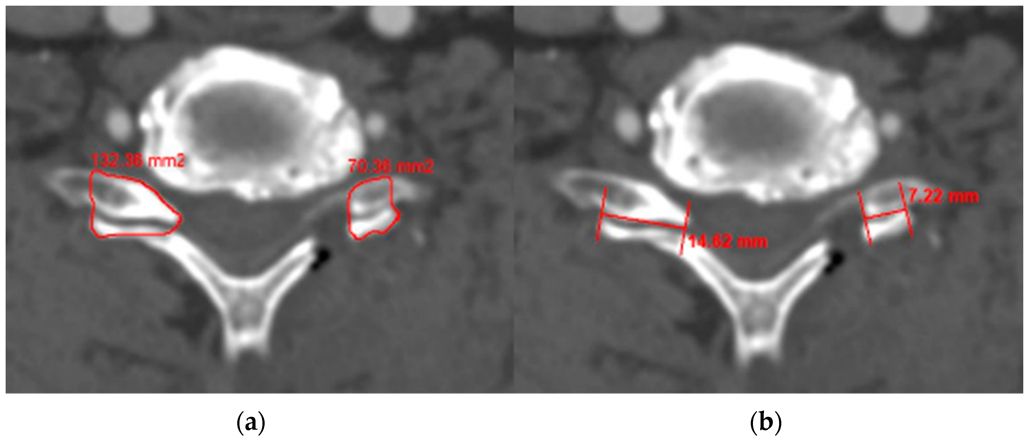 Medicina 60 01496 g001