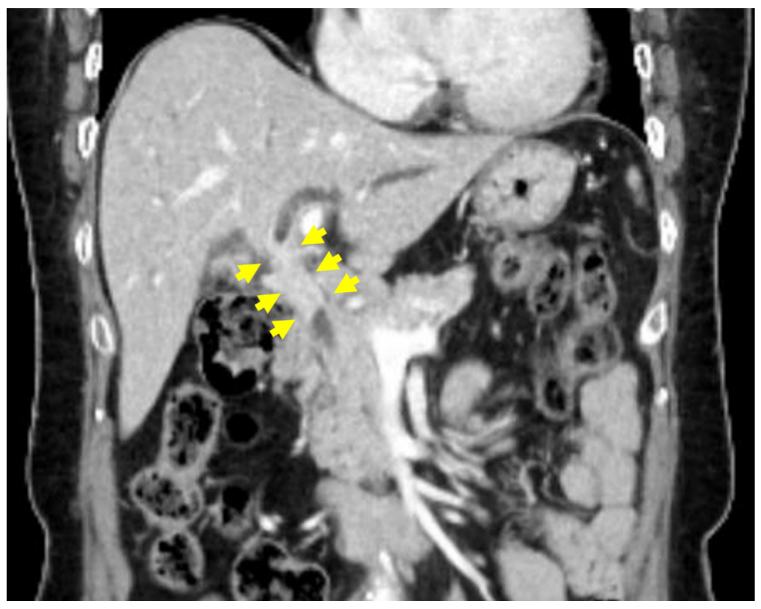 Medicina 60 01513 g001 Medicina 60 01513 g001