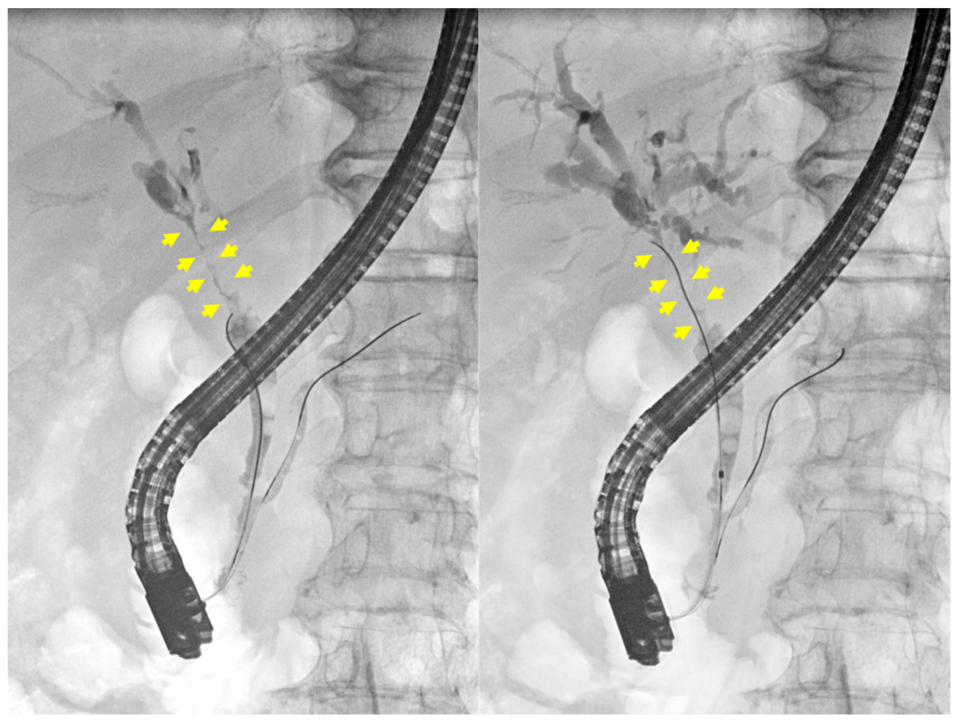 Medicina 60 01513 g003 Medicina 60 01513 g003