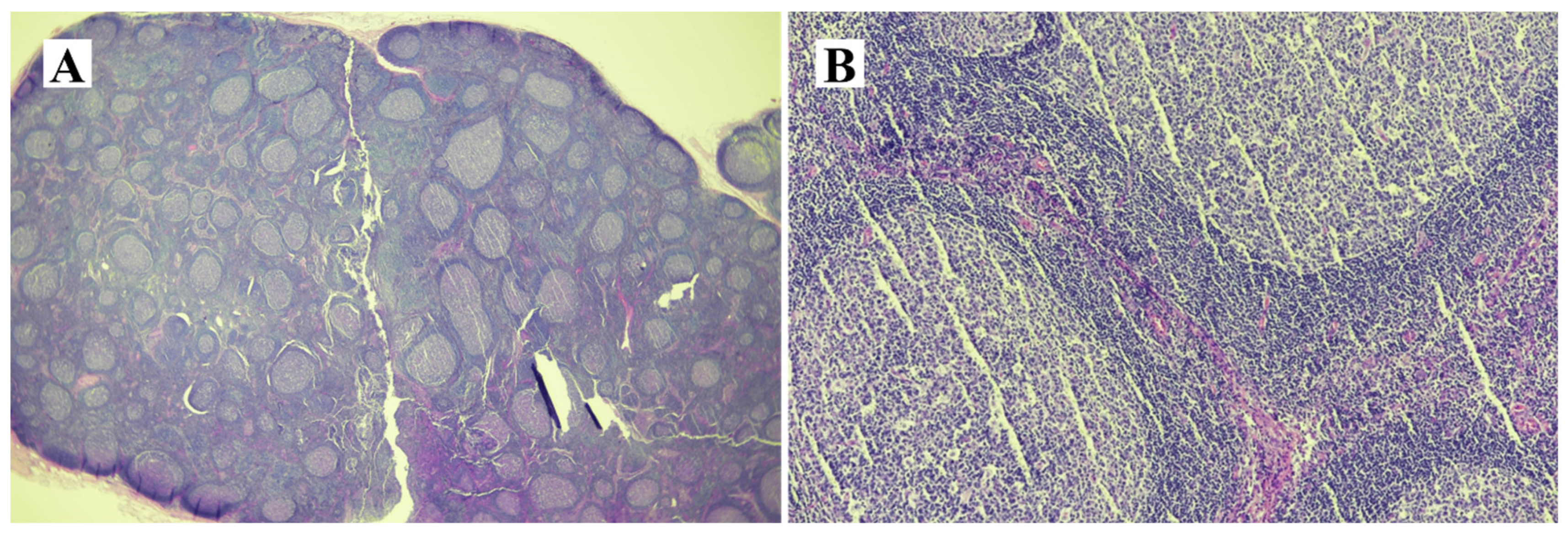 Medicina 60 01513 g006 Medicina 60 01513 g006