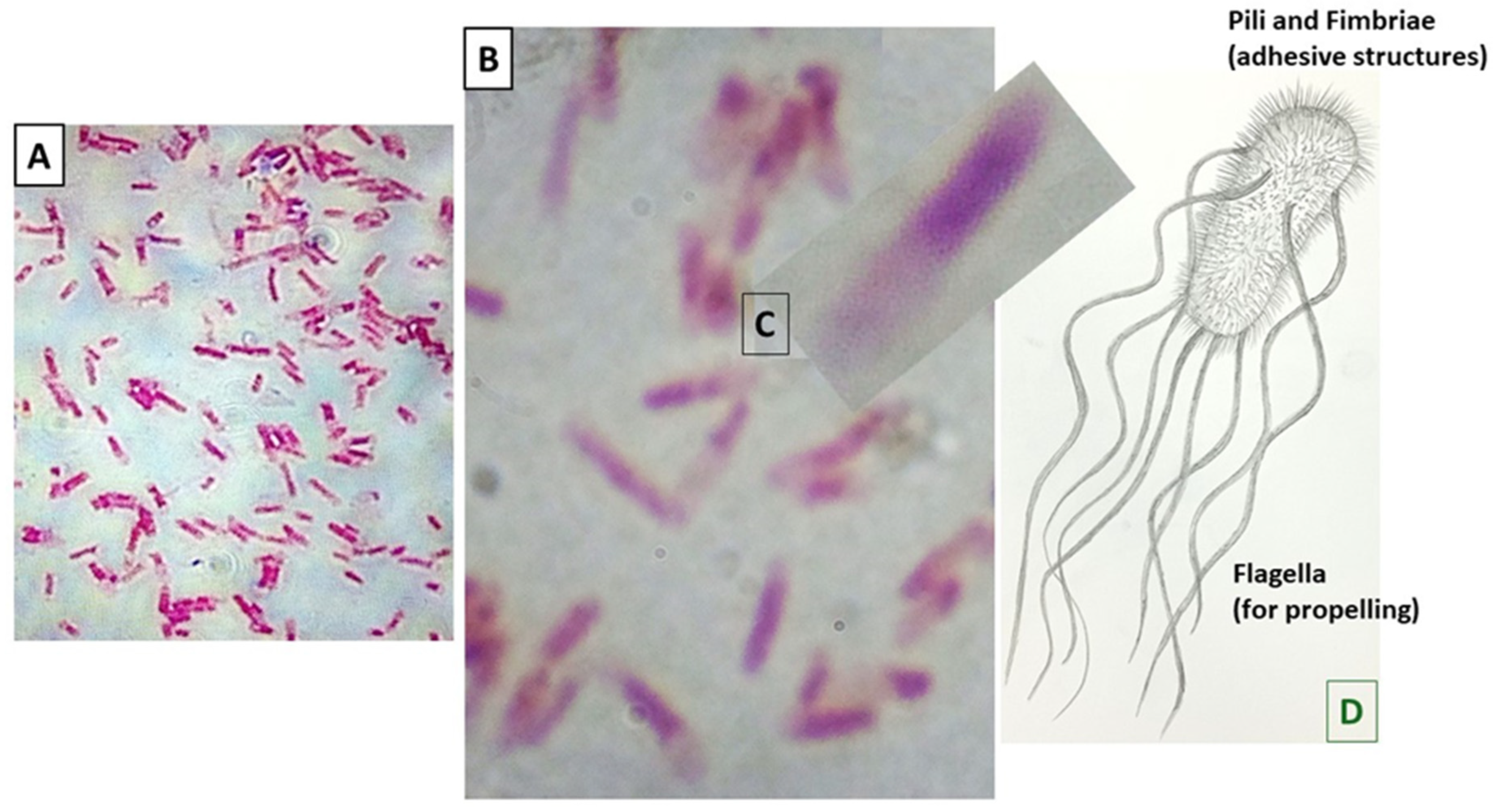 Medicina 60 01515 g002