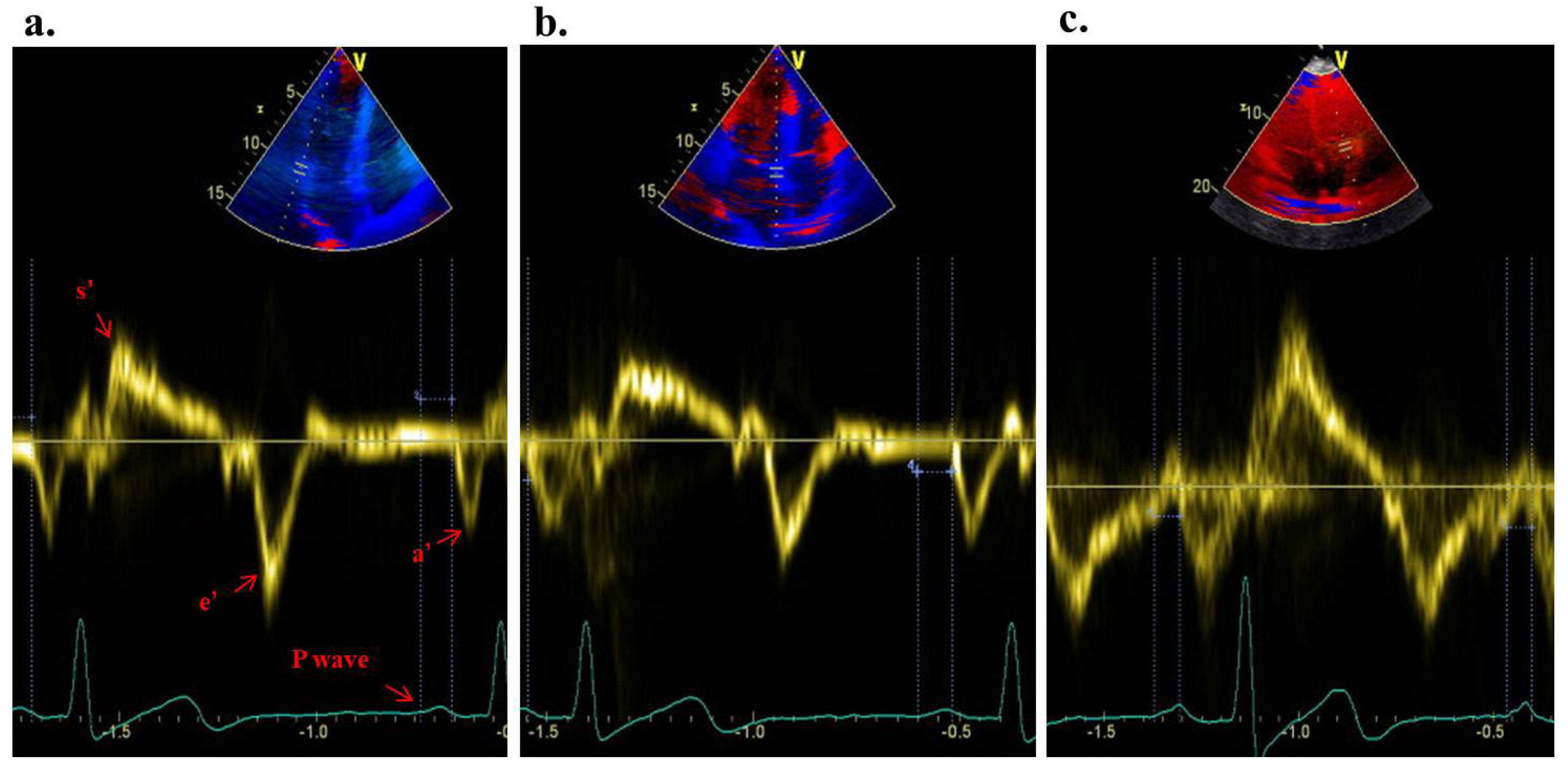 Medicina 60 01516 g001
