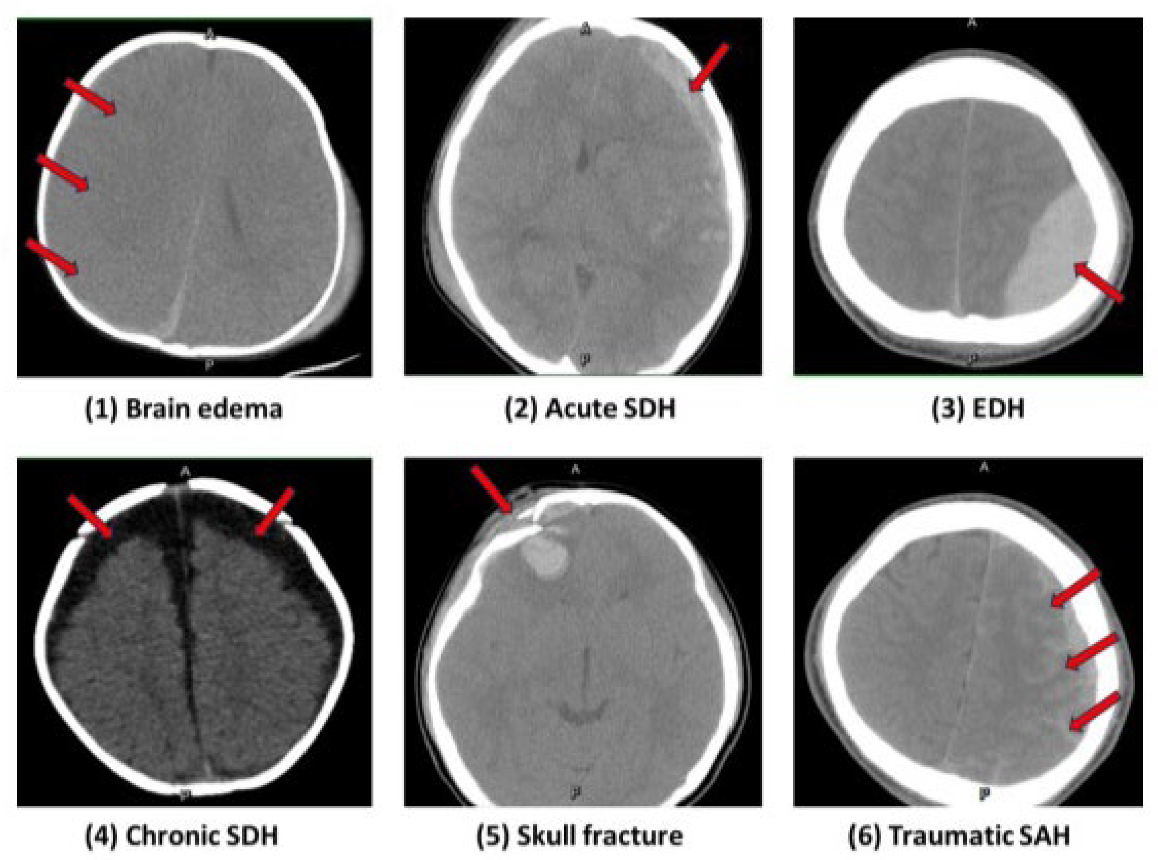 Medicina 60 01518 g001
