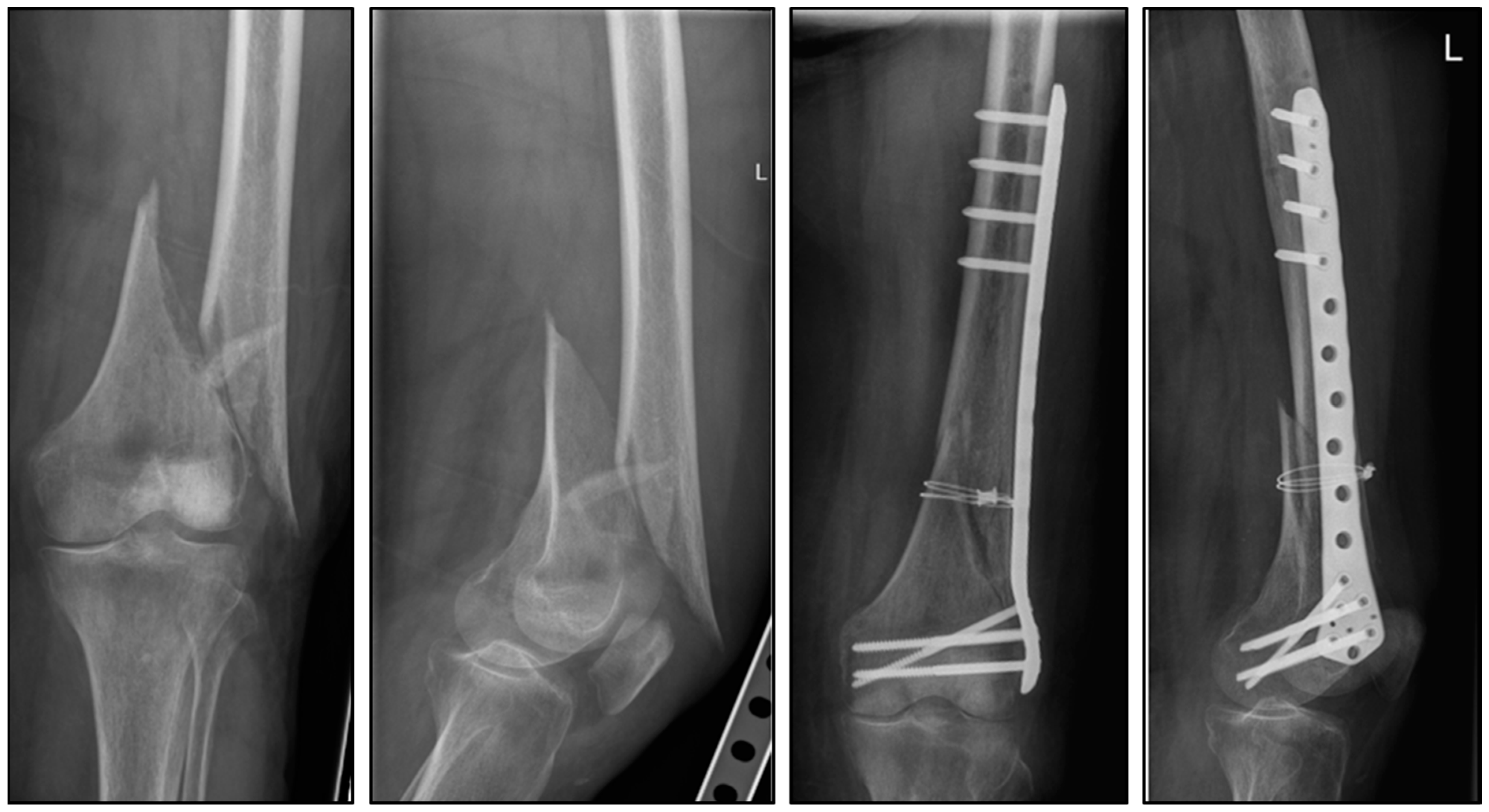 Medicina 60 01524 g001