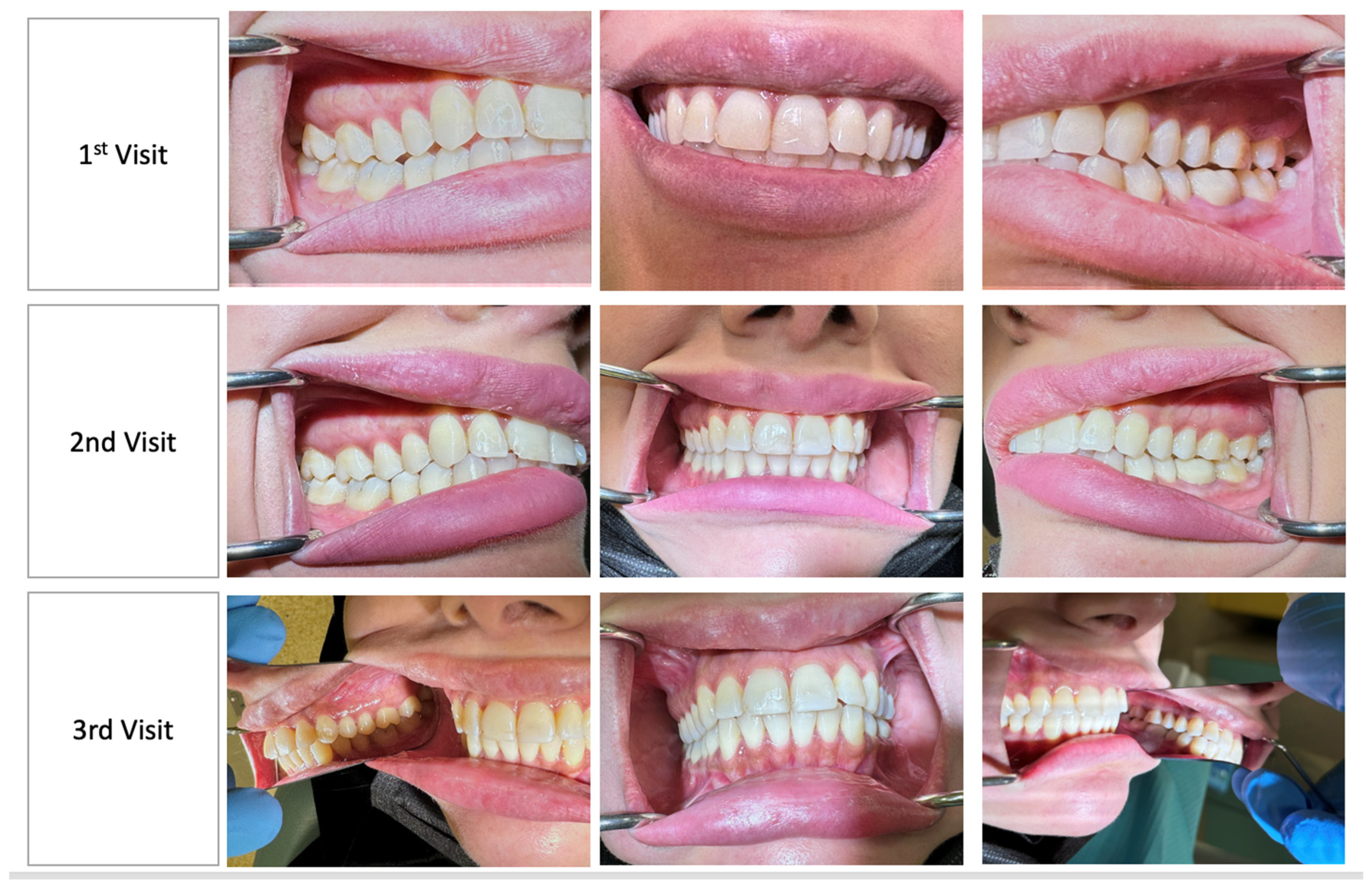 Medicina 60 01527 g001