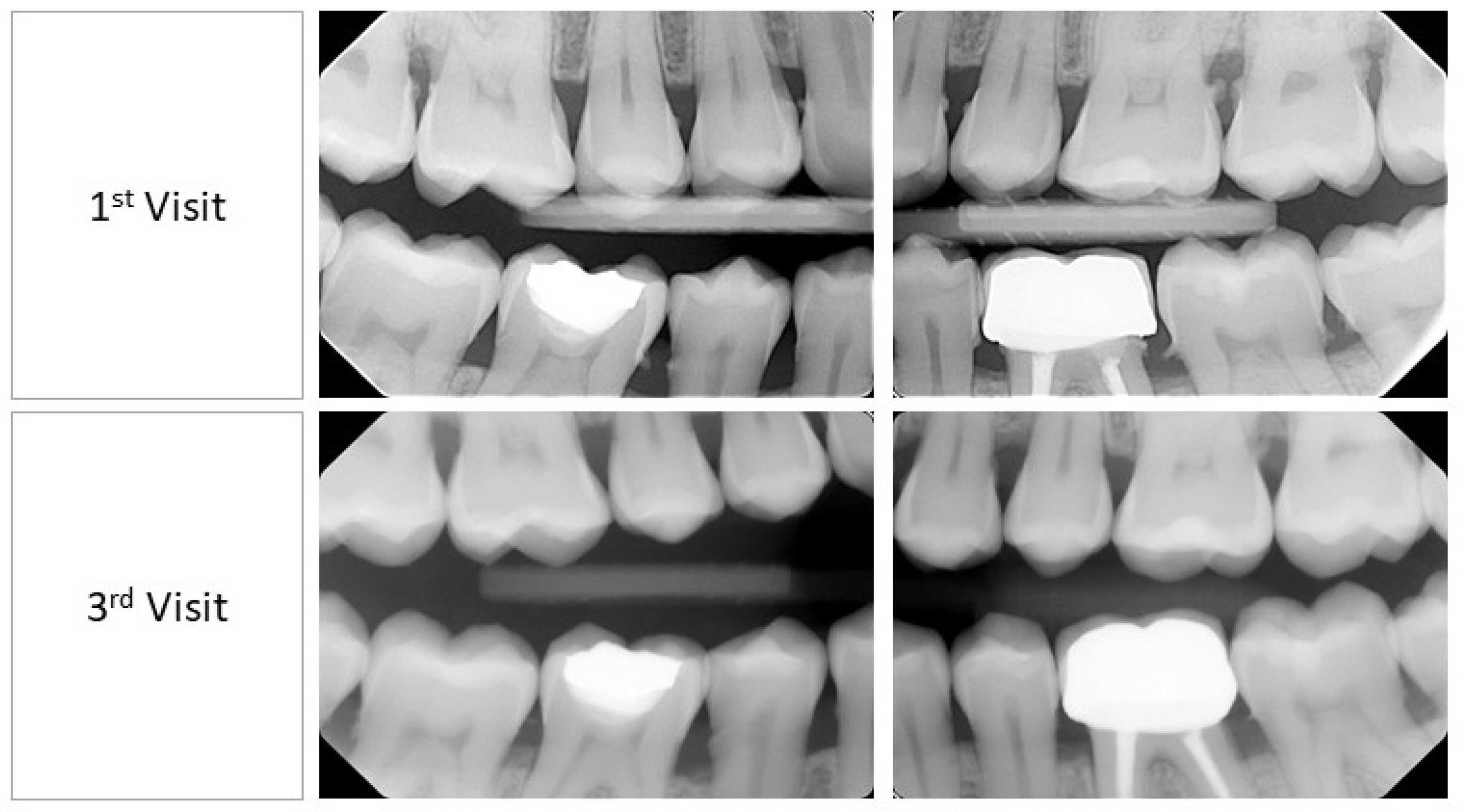 Medicina 60 01527 g002