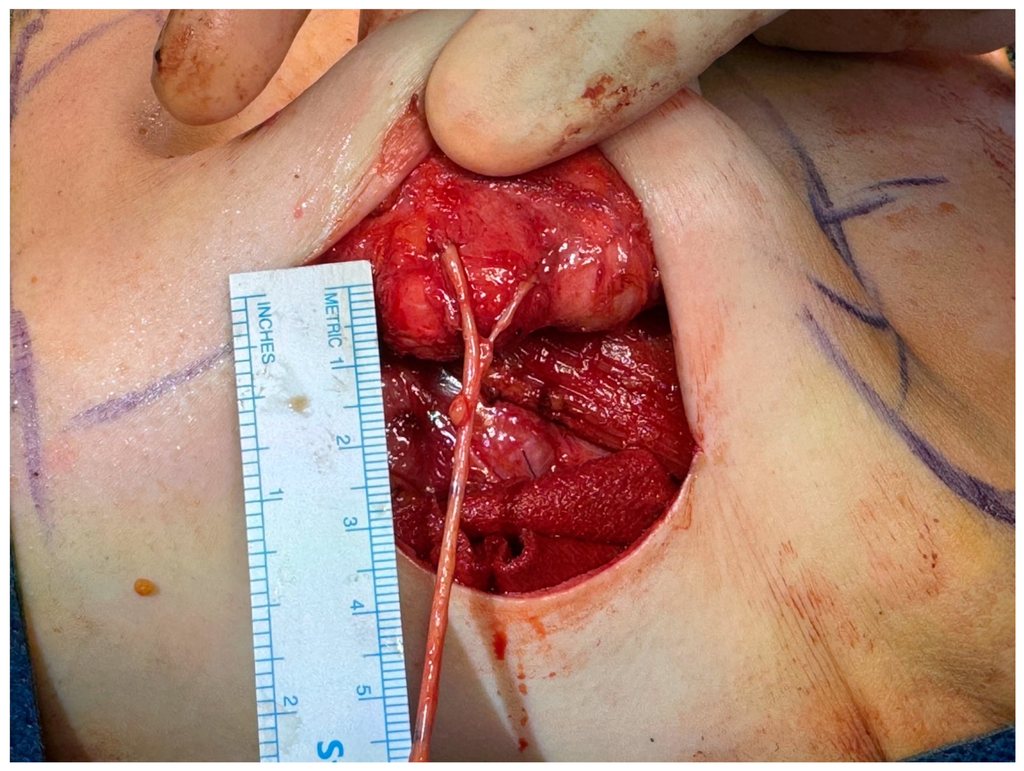 Medicina 60 01533 g001