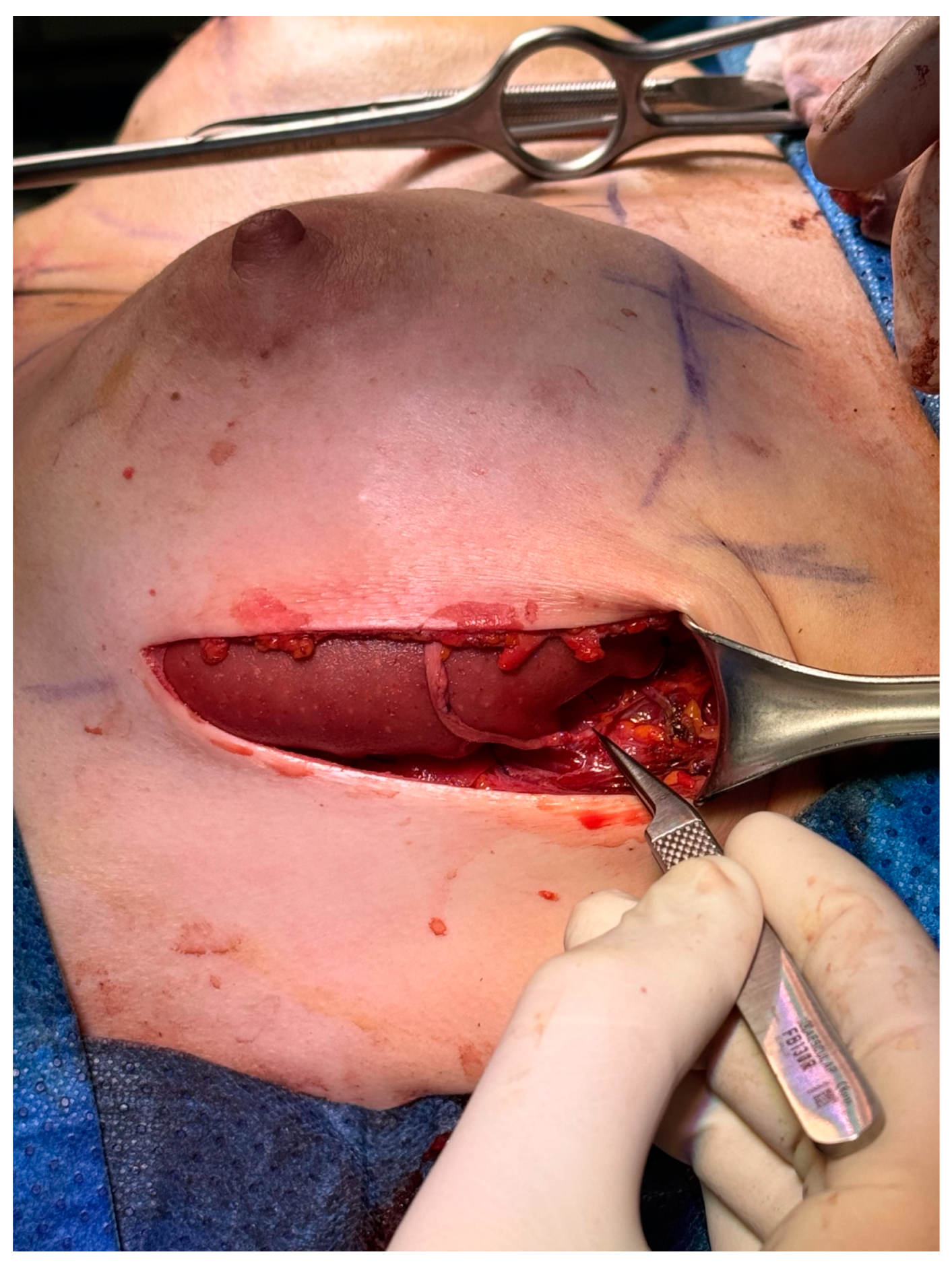 Medicina 60 01533 g002