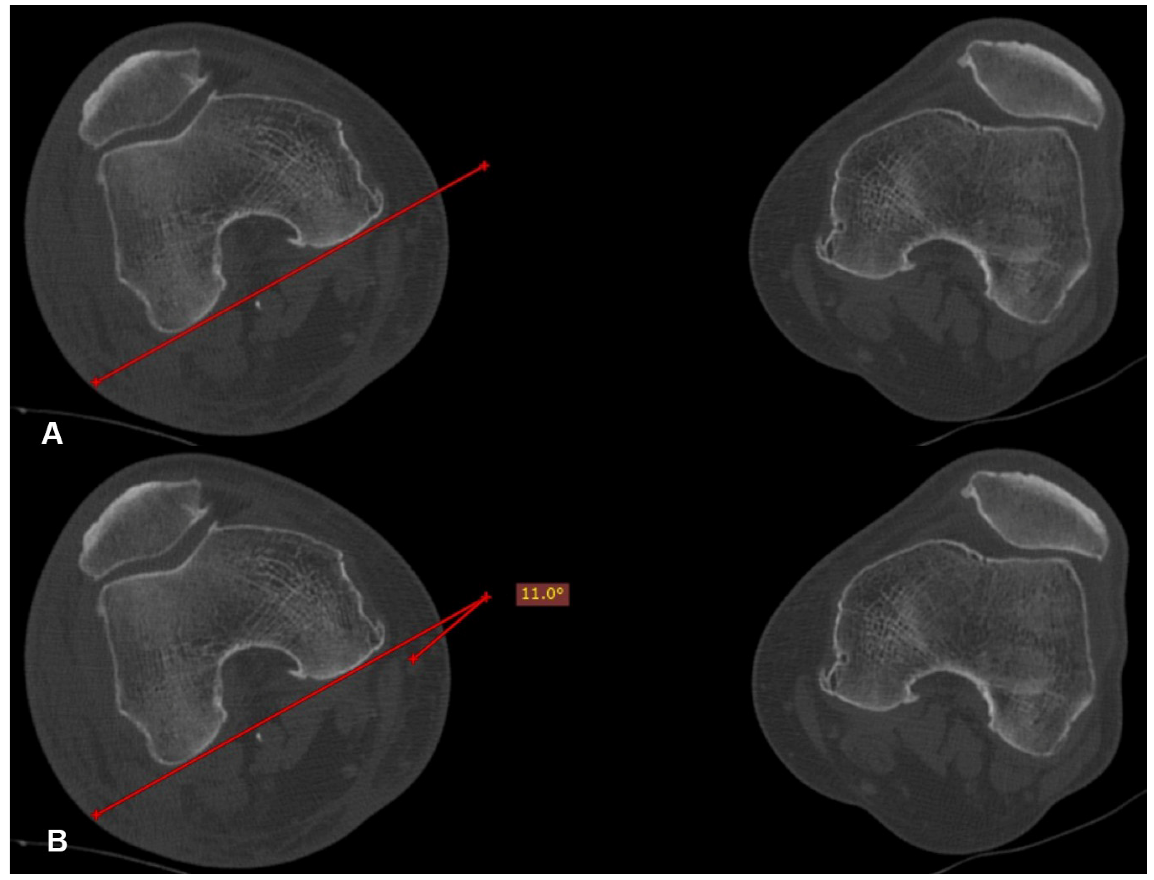 Medicina 60 01535 g004