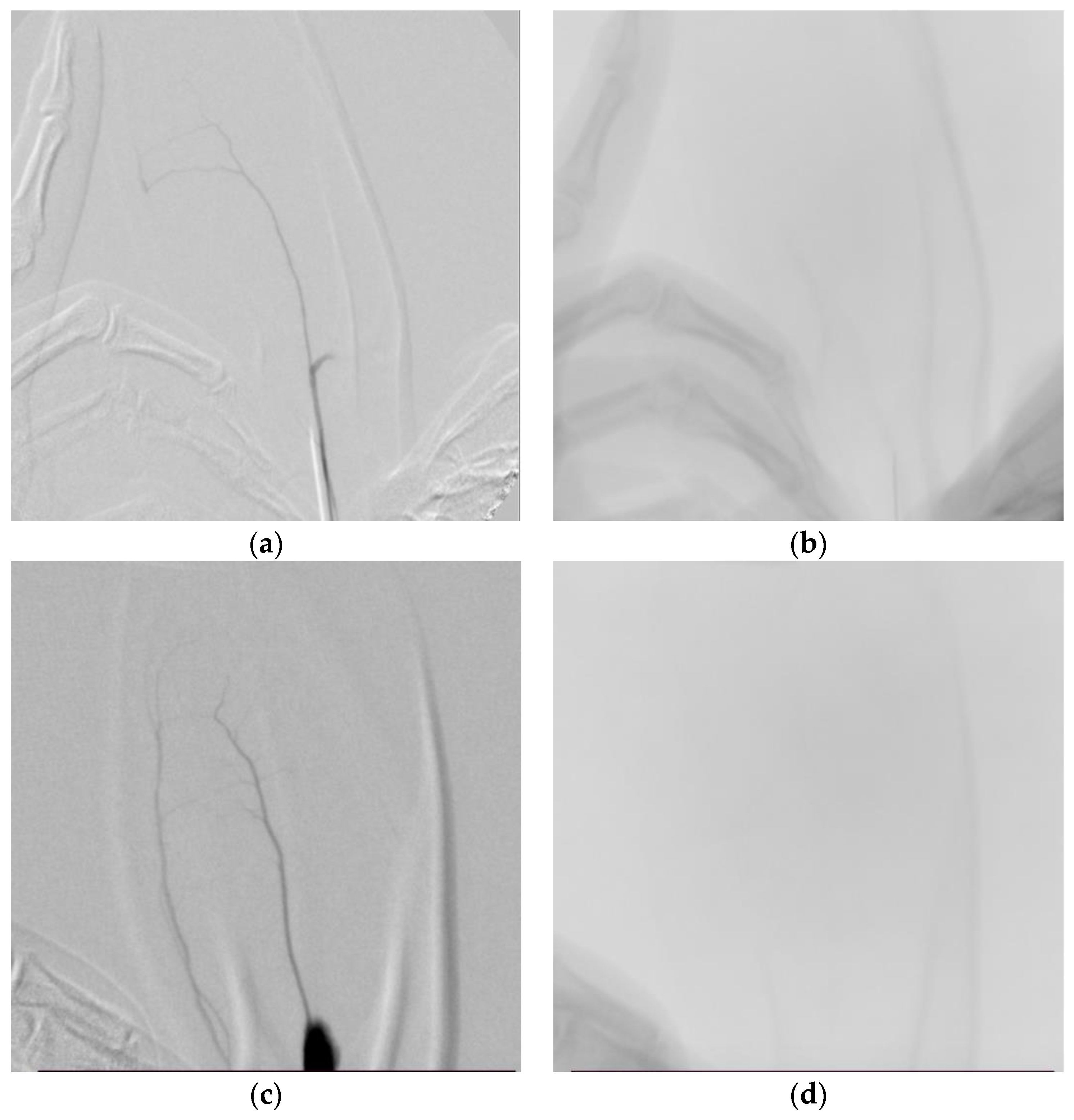 Medicina 60 01538 g003a