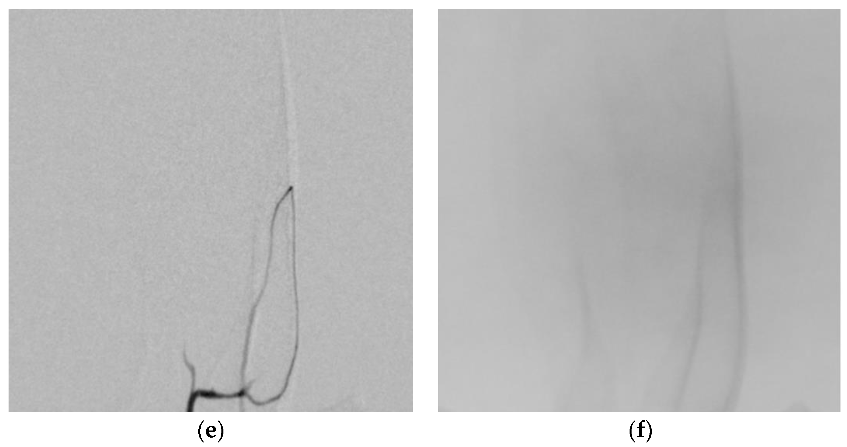 Medicina 60 01538 g003b