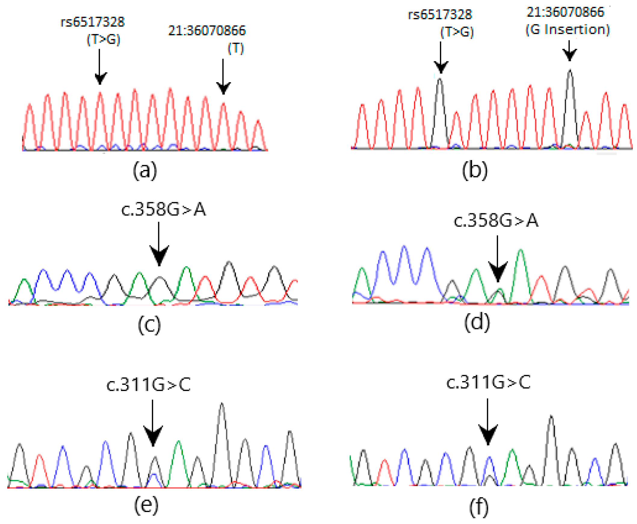 Medicina 60 01540 g003