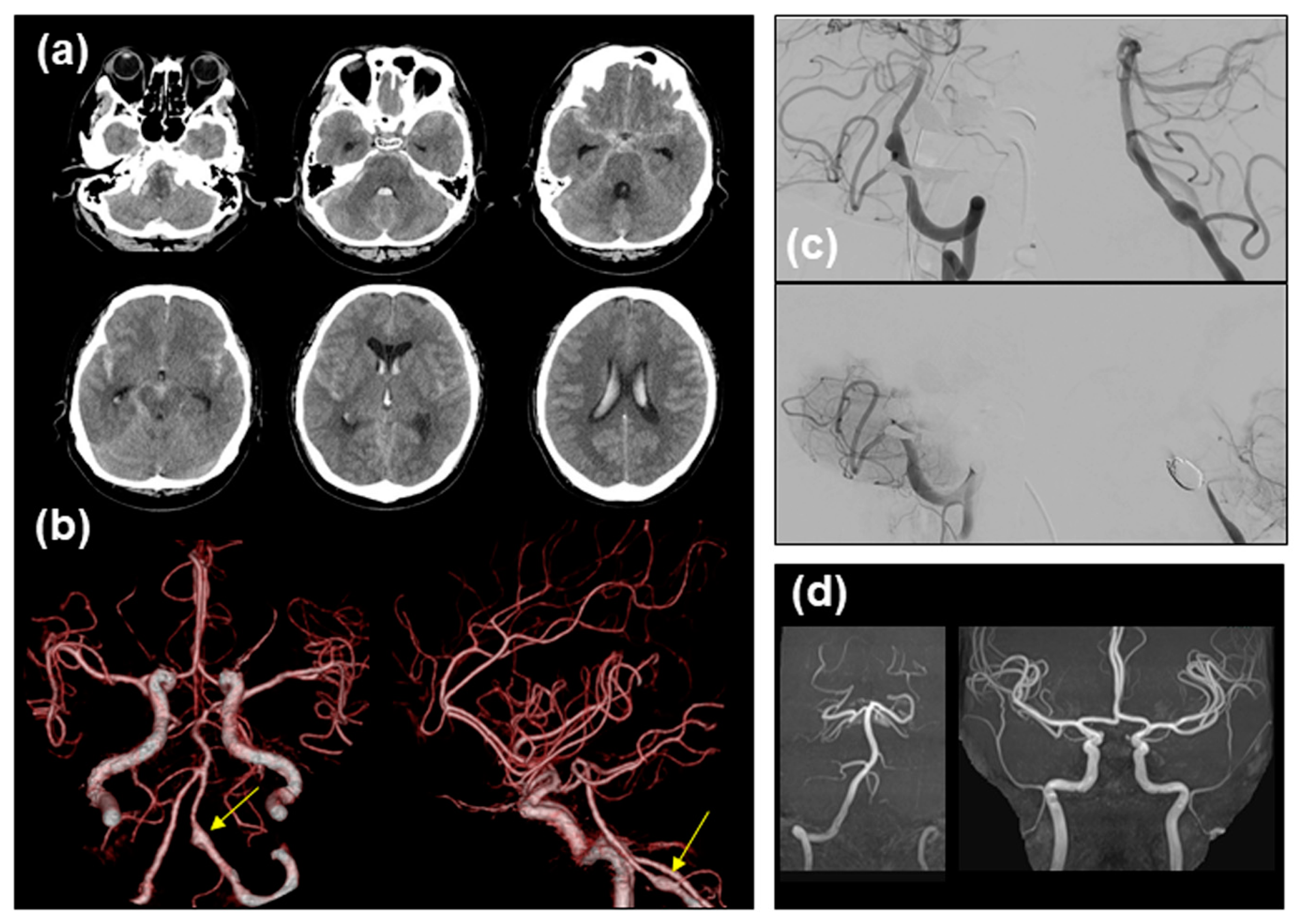 Medicina 60 01543 g003