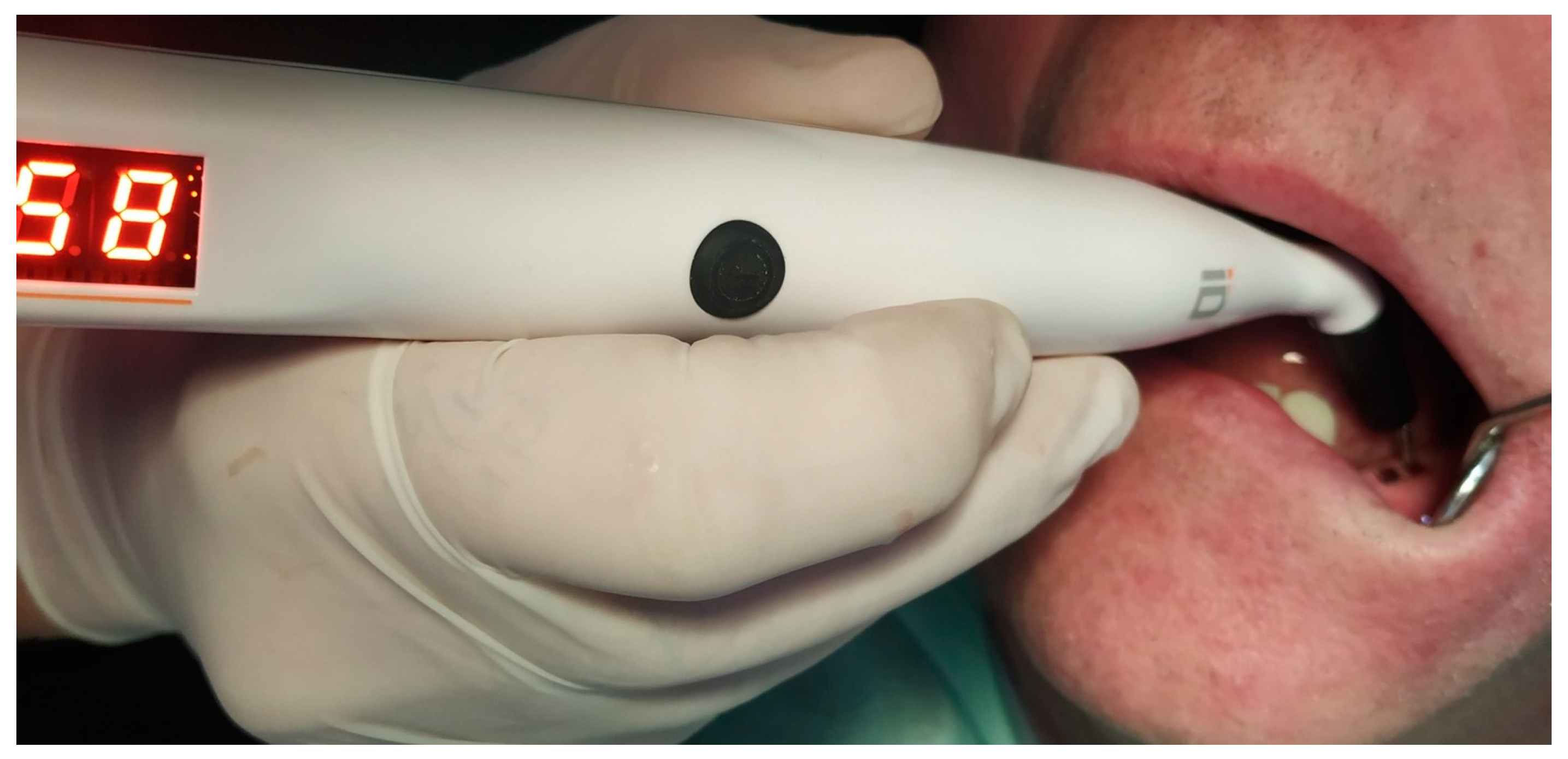 Medicina 60 01546 g002