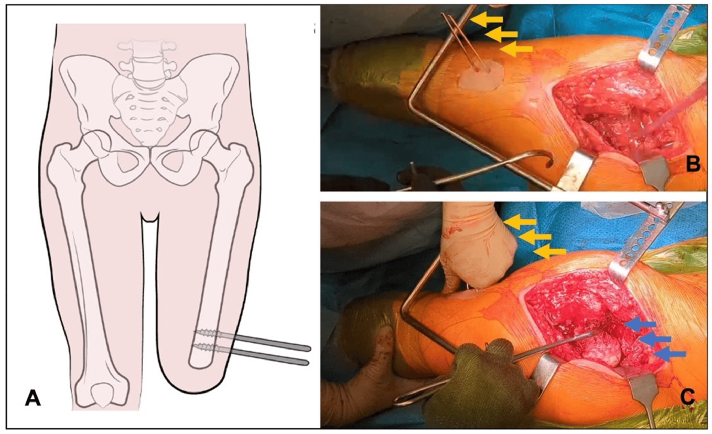 Medicina 60 01551 g001