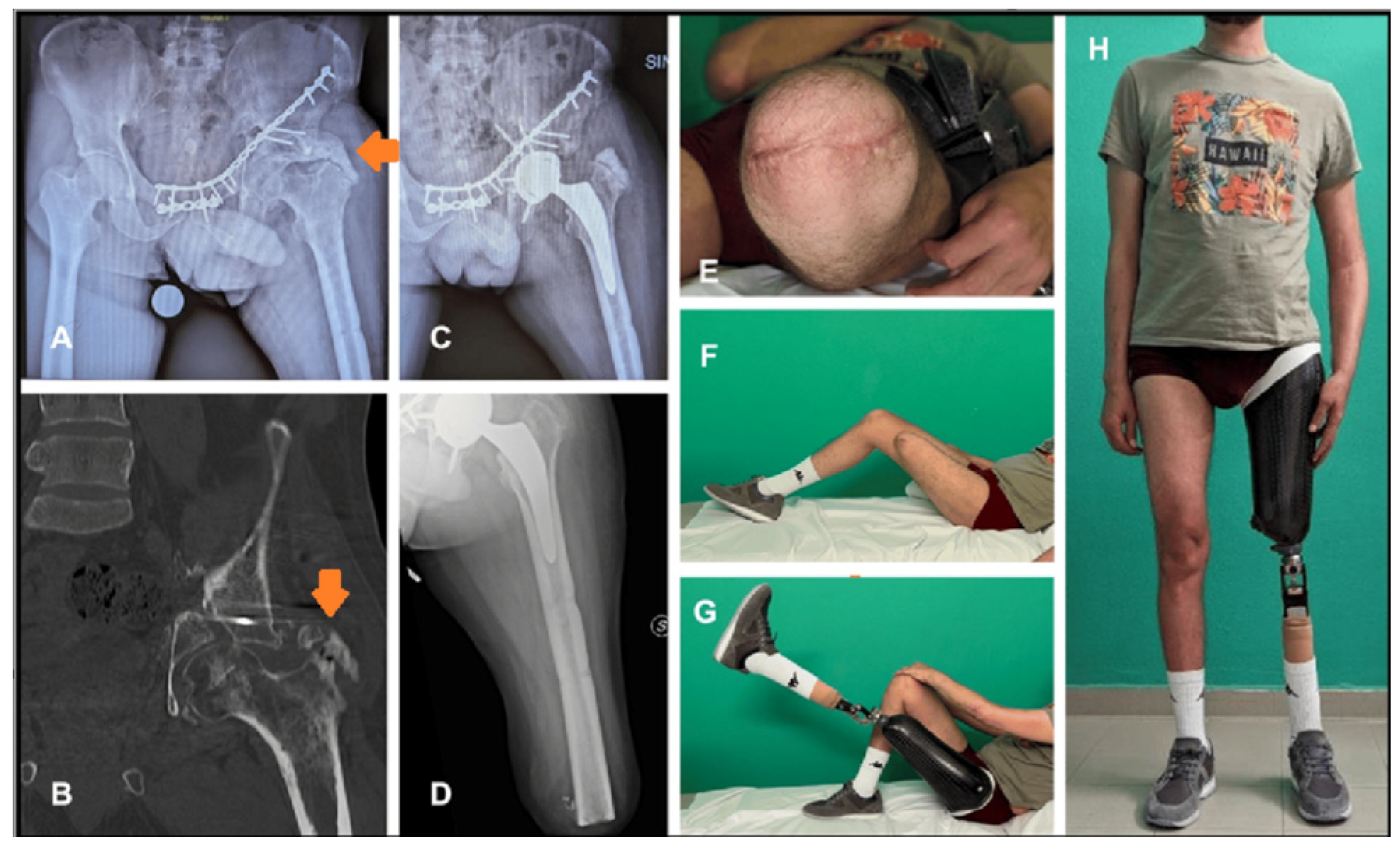 Medicina 60 01551 g002