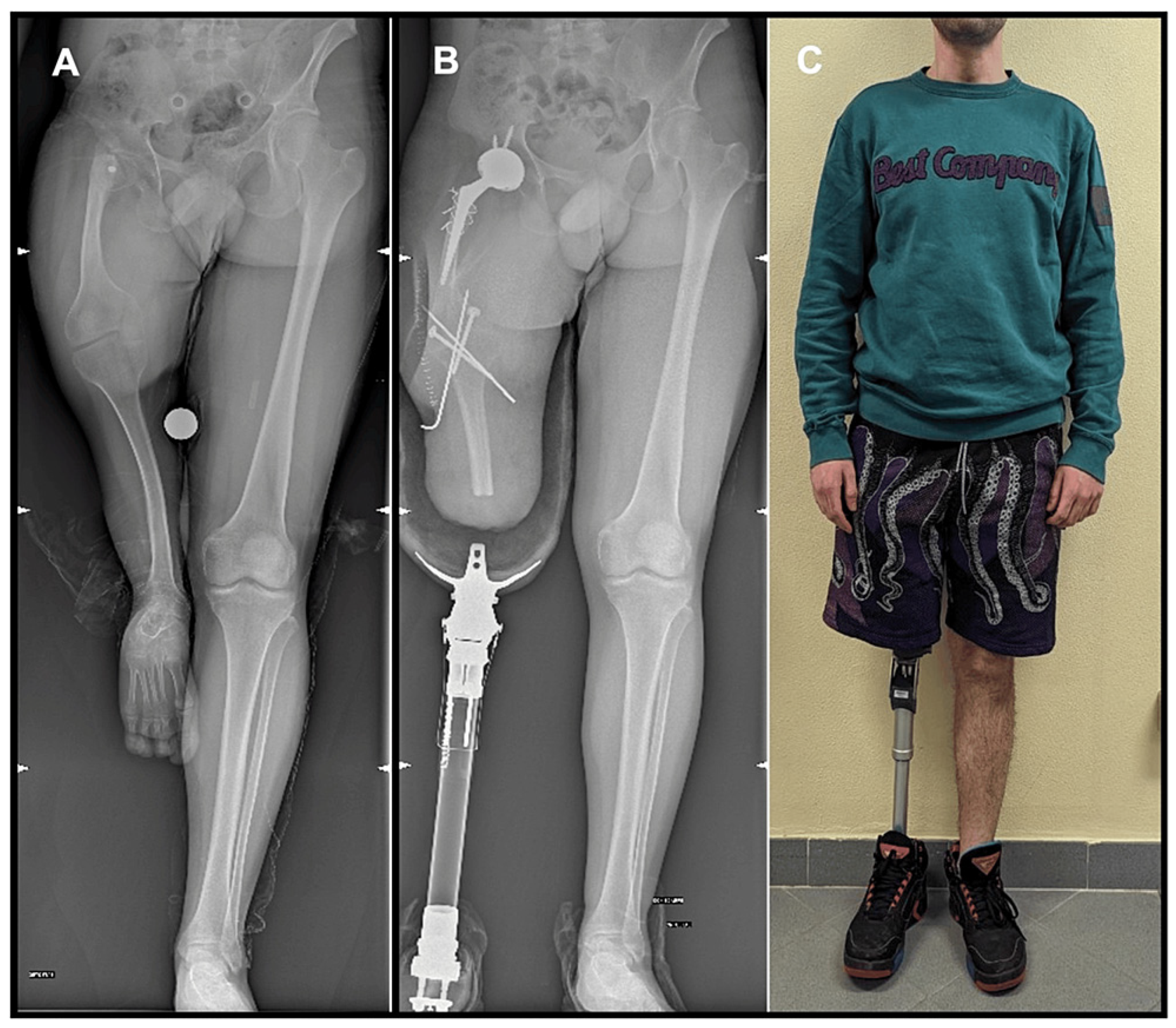 Medicina 60 01551 g003