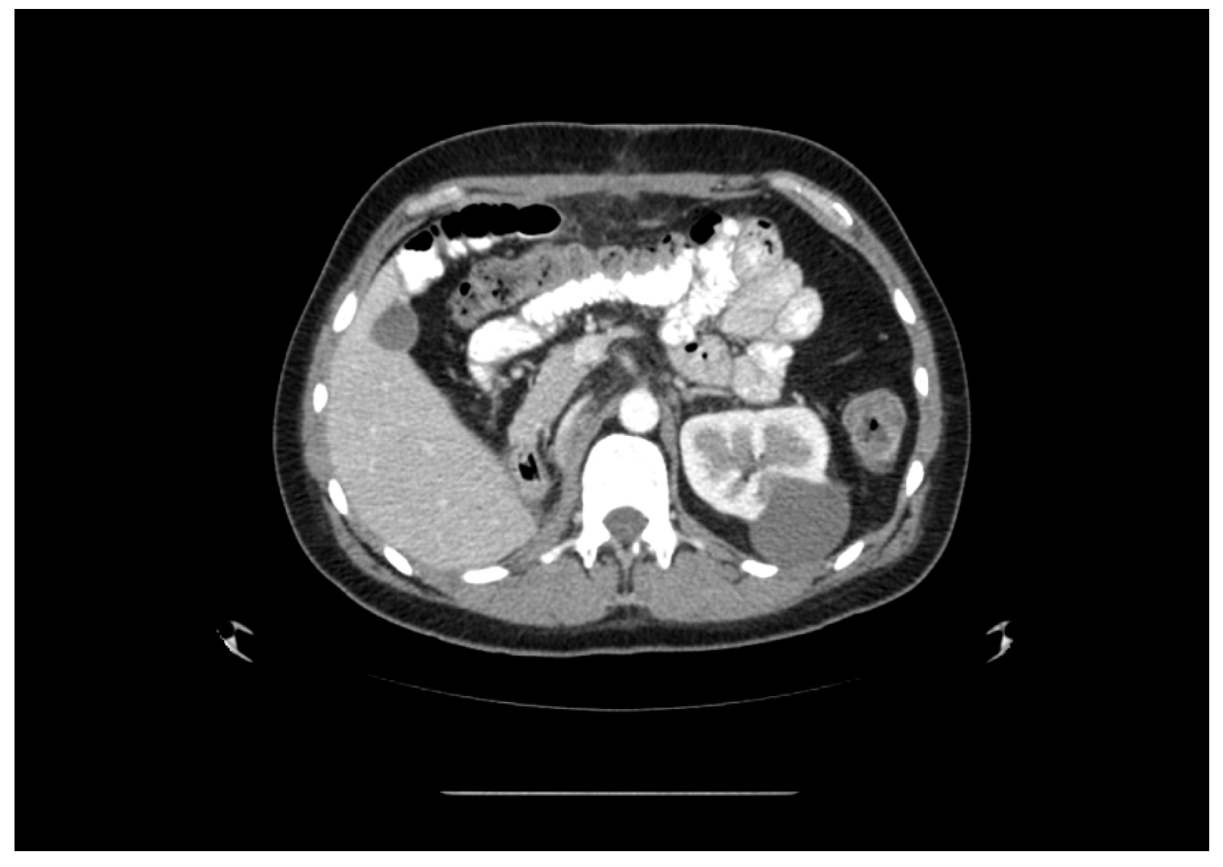 Medicina 60 01553 g003