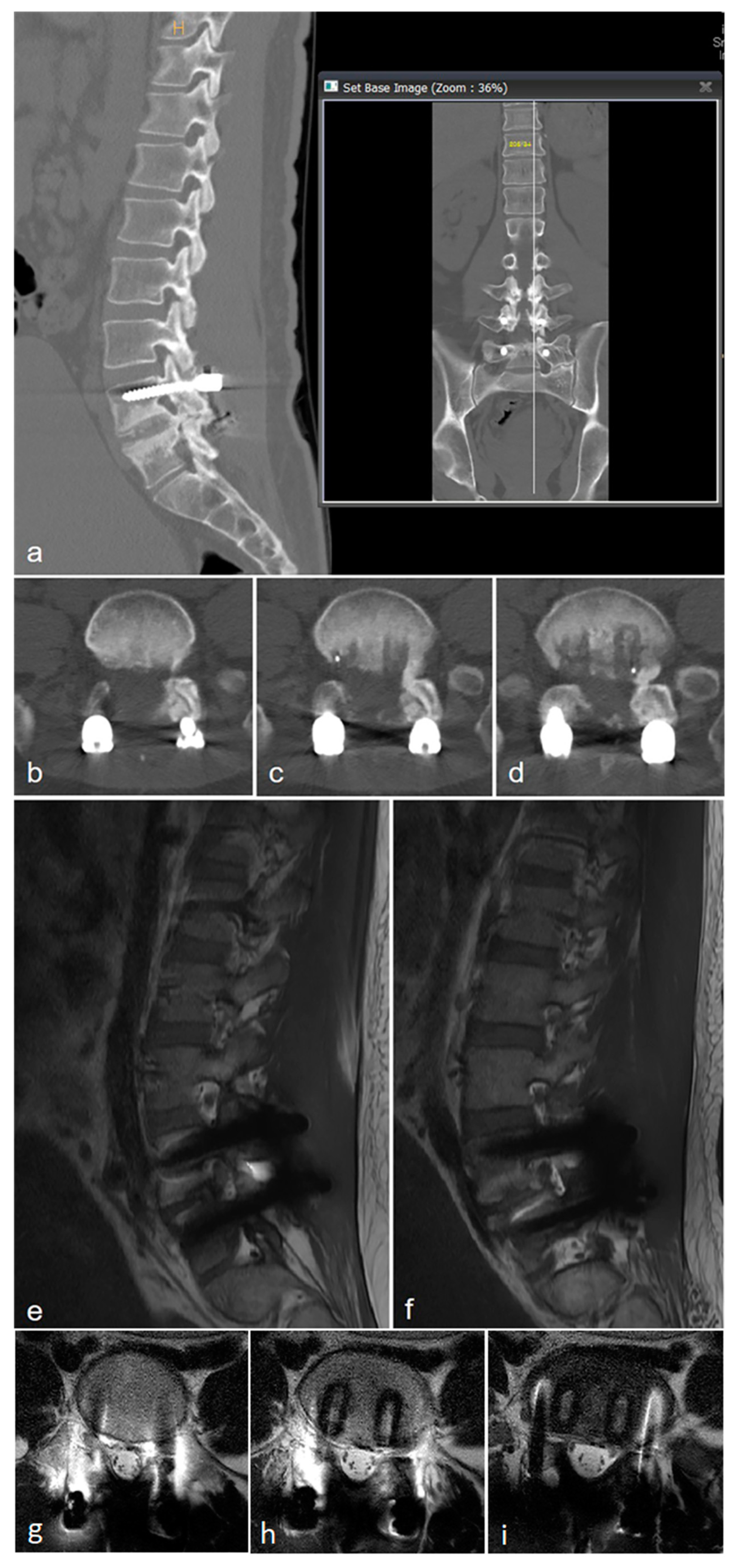 Medicina 60 01554 g003