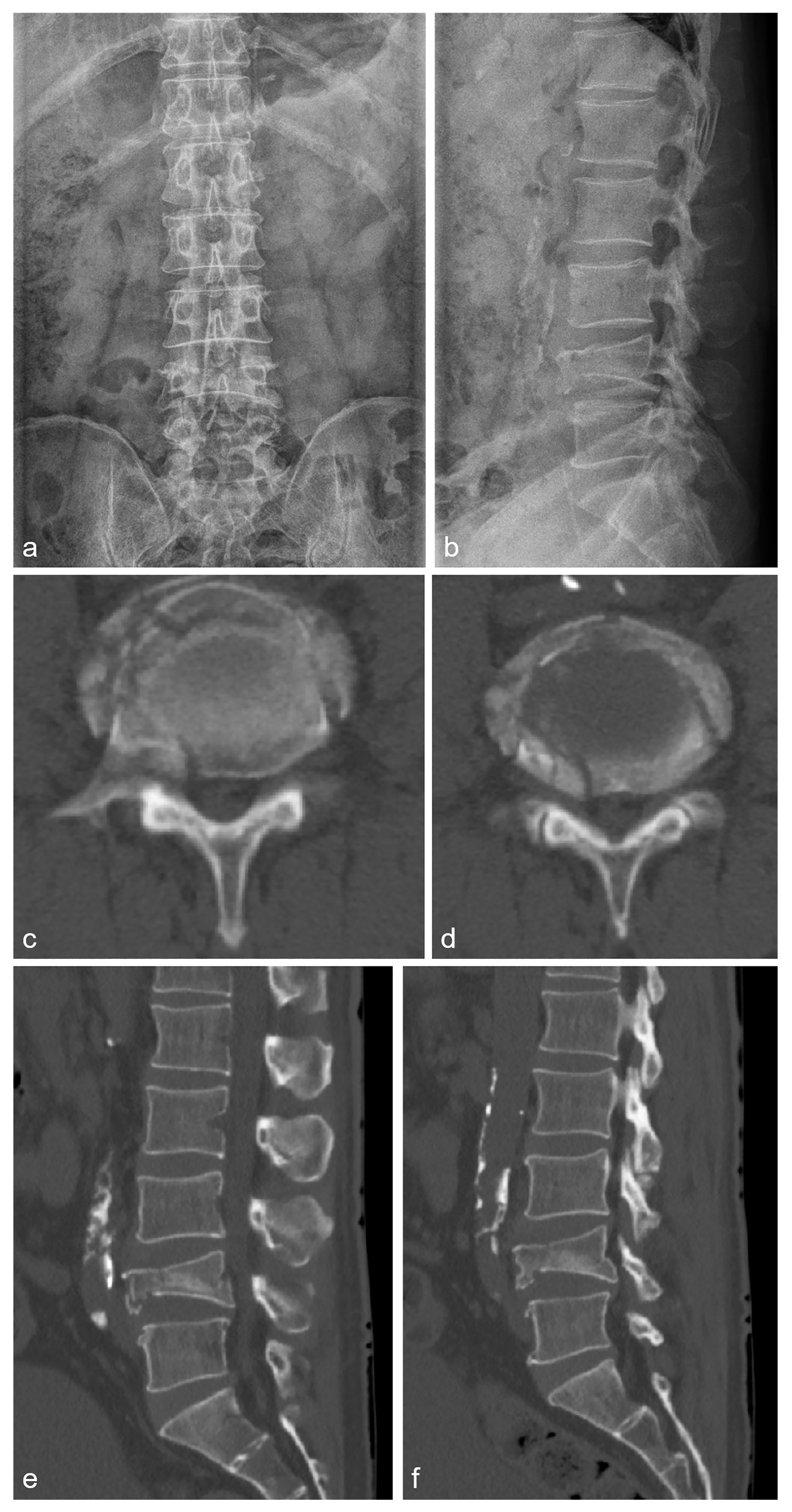 Medicina 60 01554 g005
