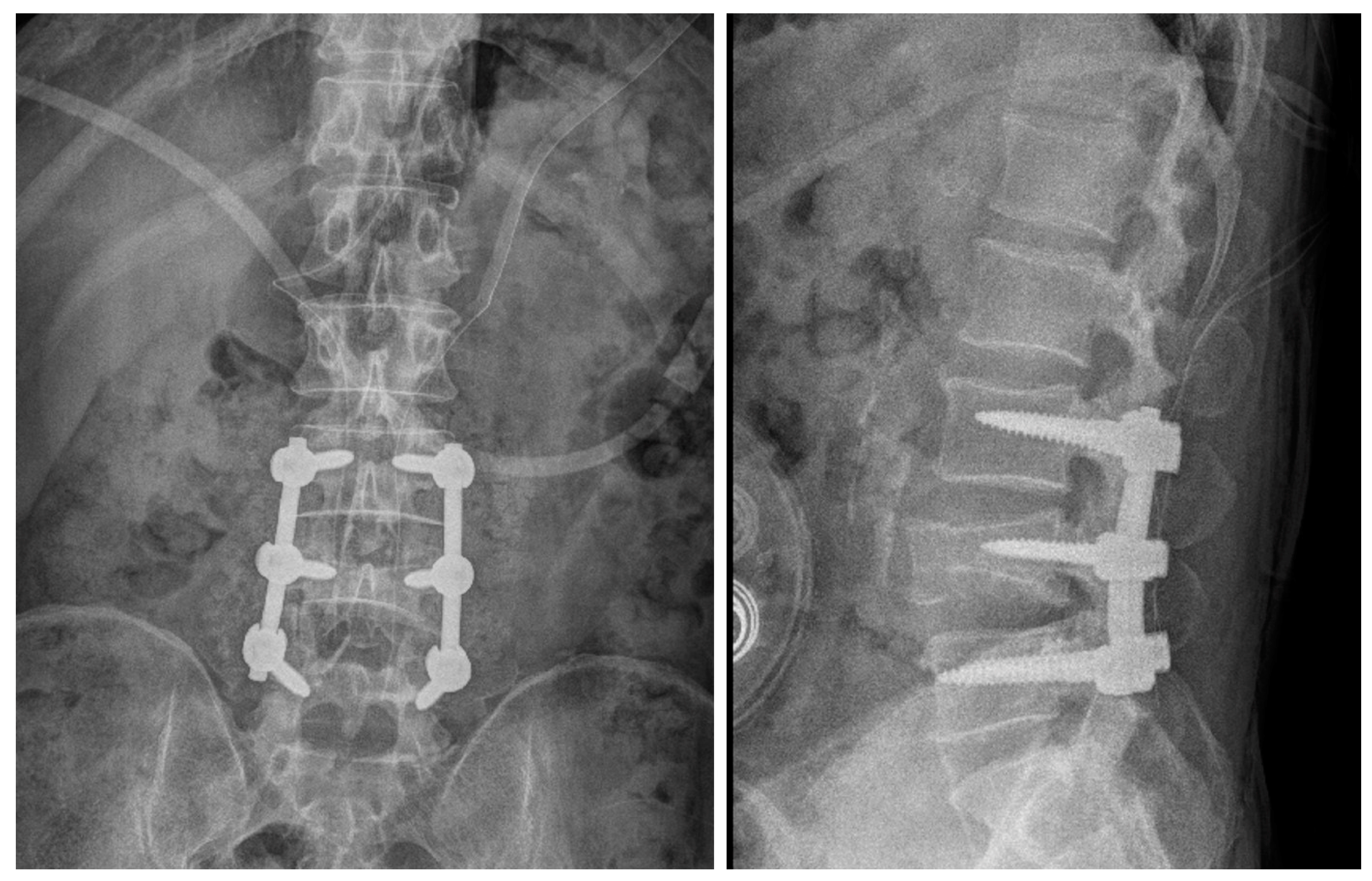 Medicina 60 01554 g006