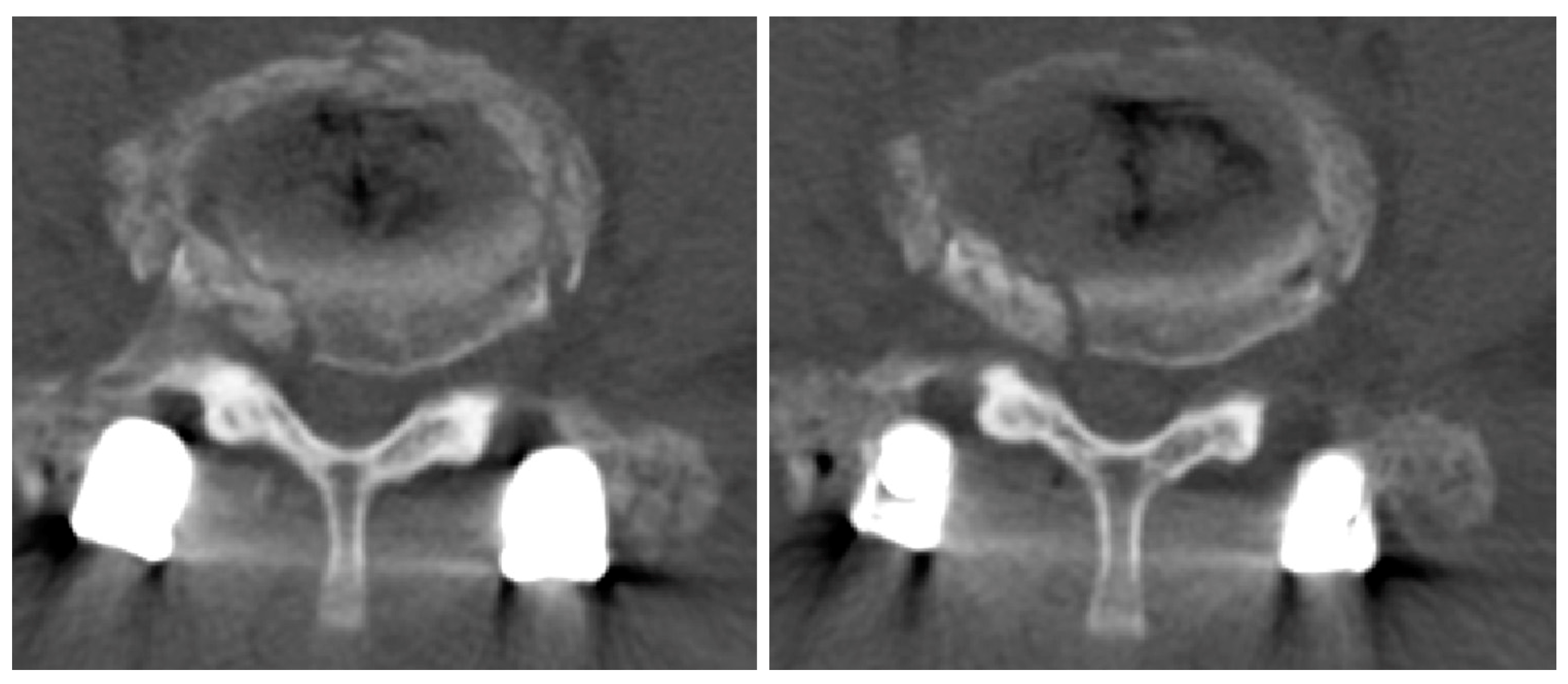 Medicina 60 01554 g007