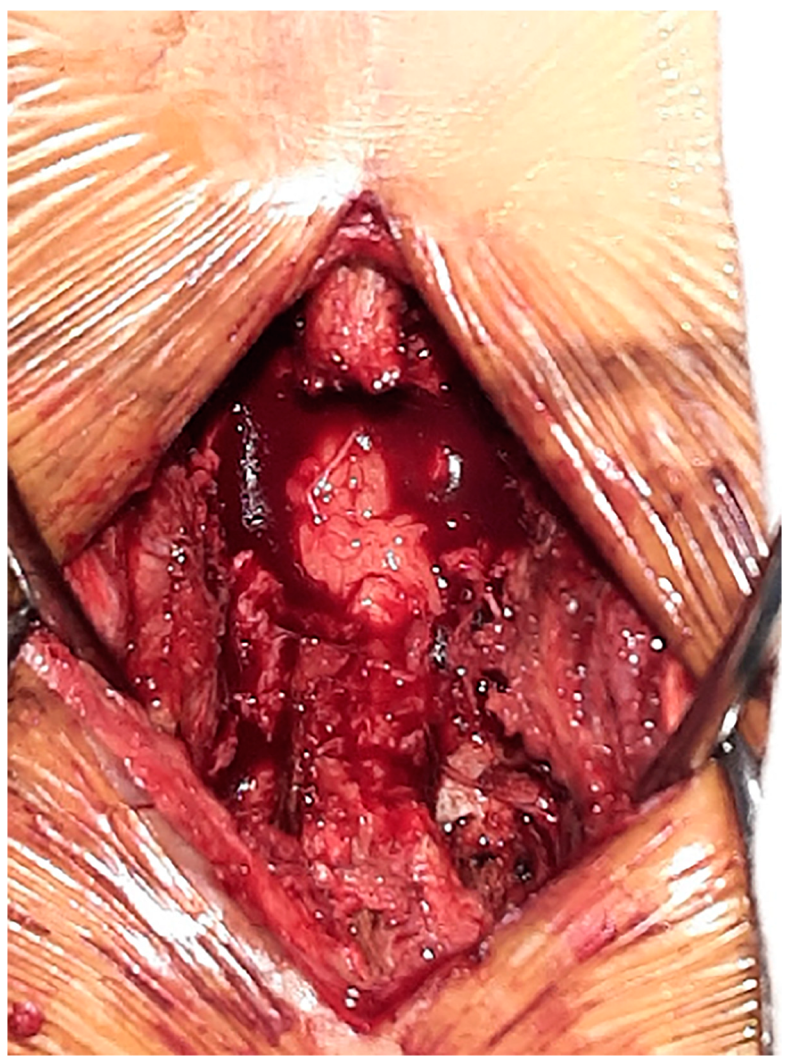 Medicina 60 01554 g008