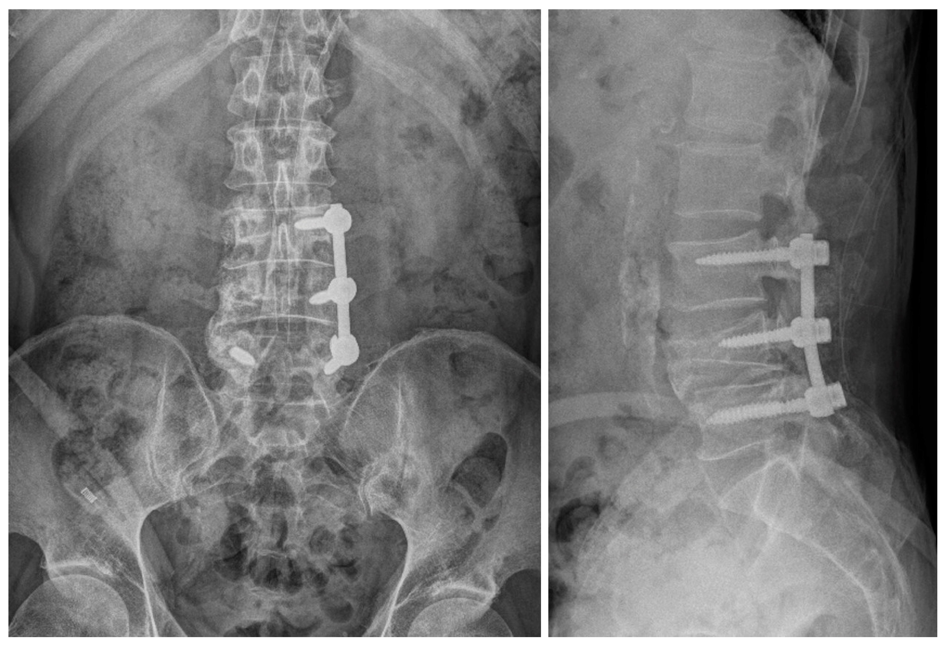 Medicina 60 01554 g010