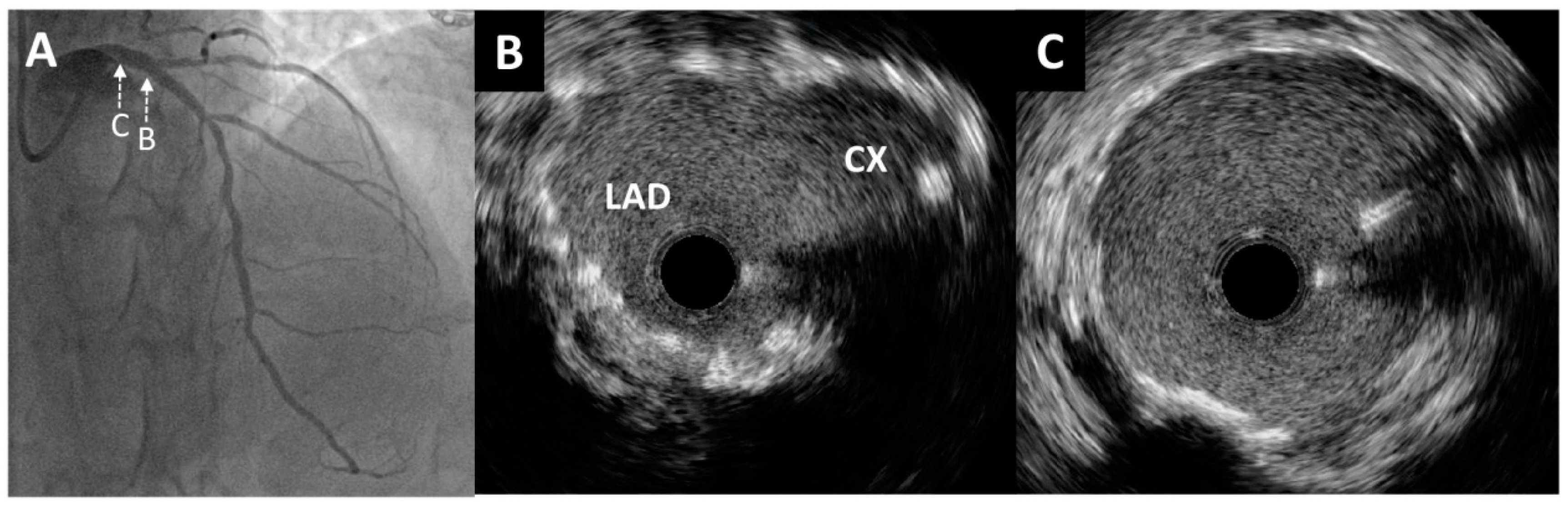 Medicina 60 01563 g005