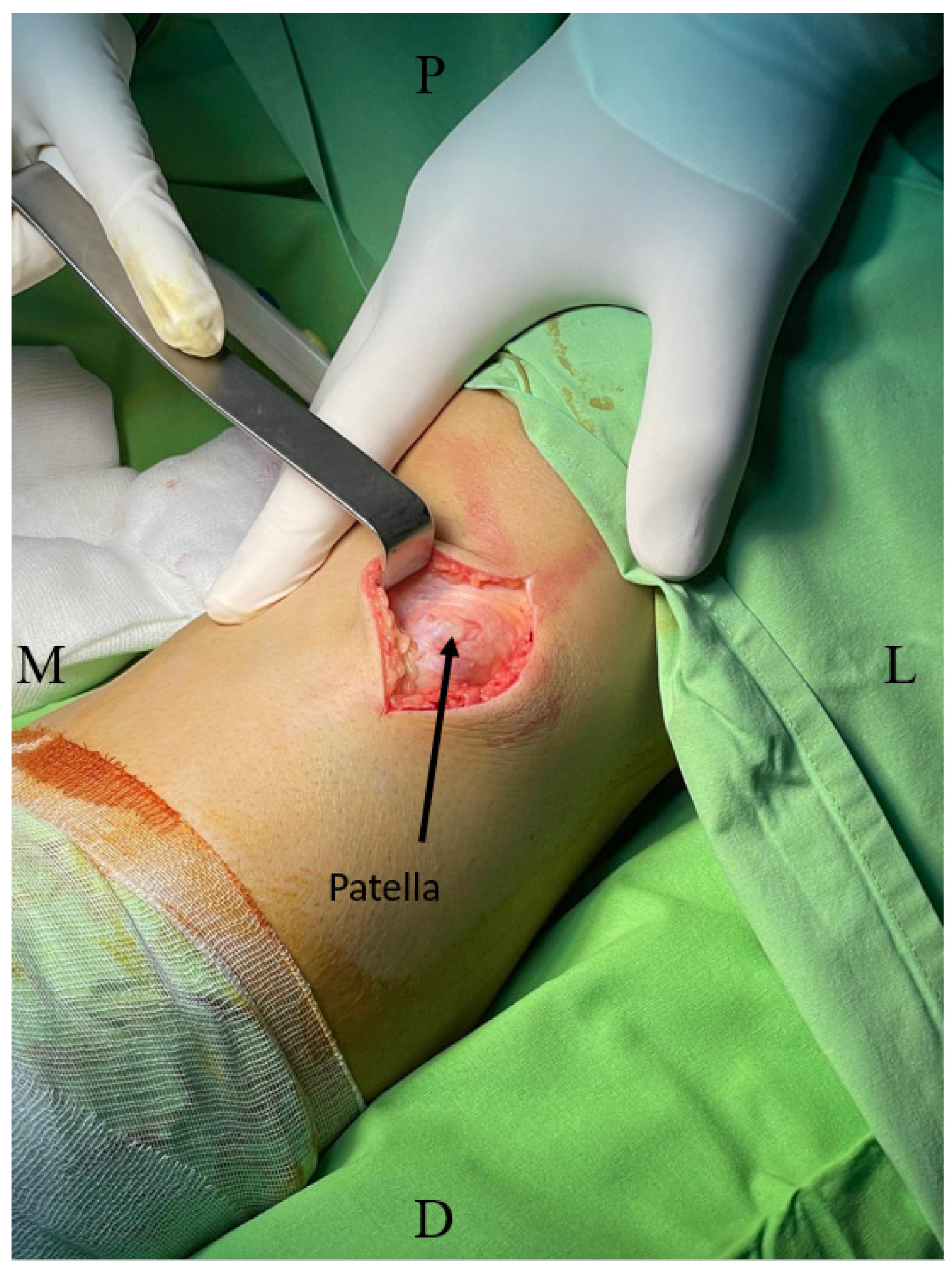 Medicina 60 01570 g001