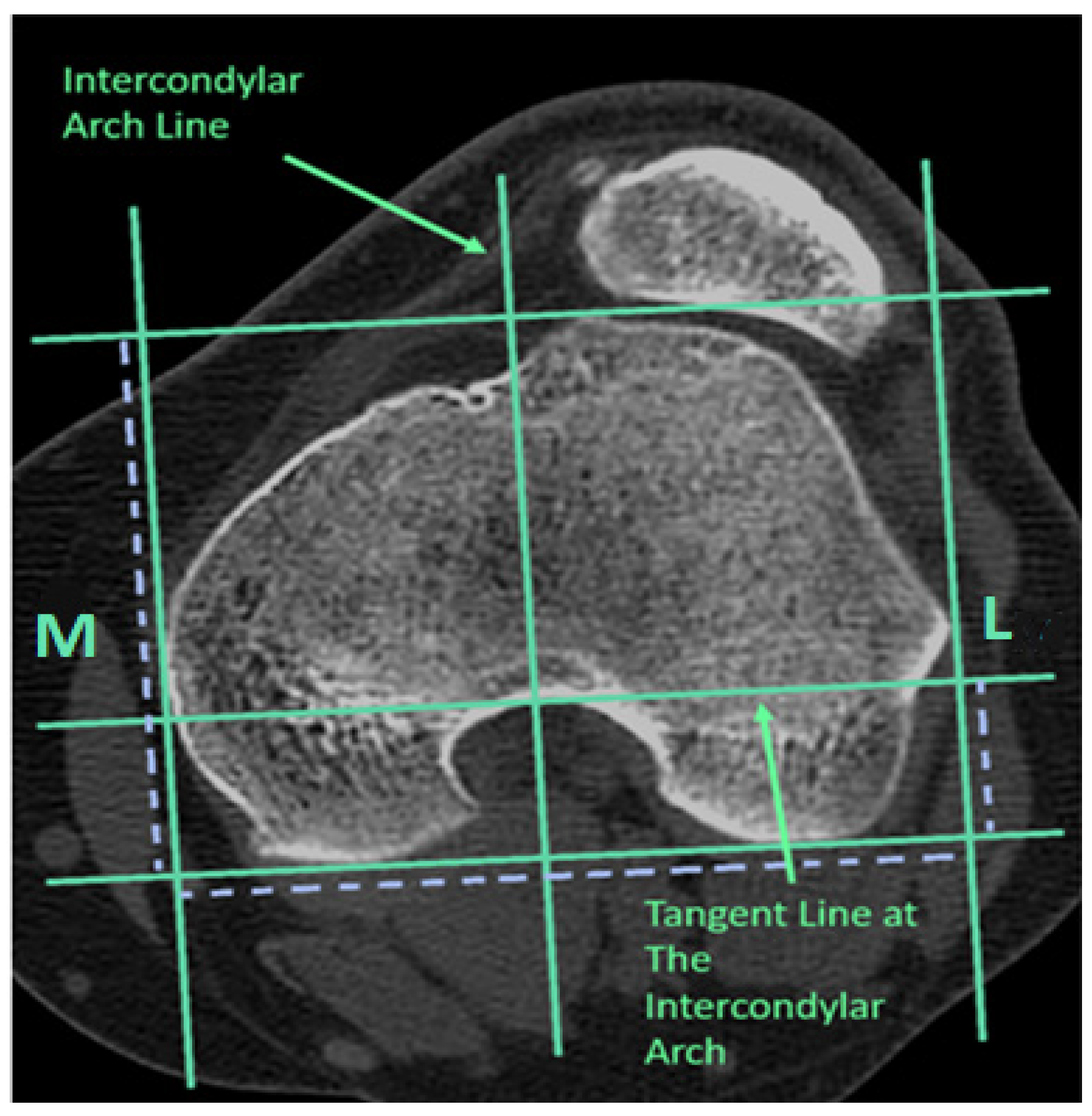 Medicina 60 01570 g002