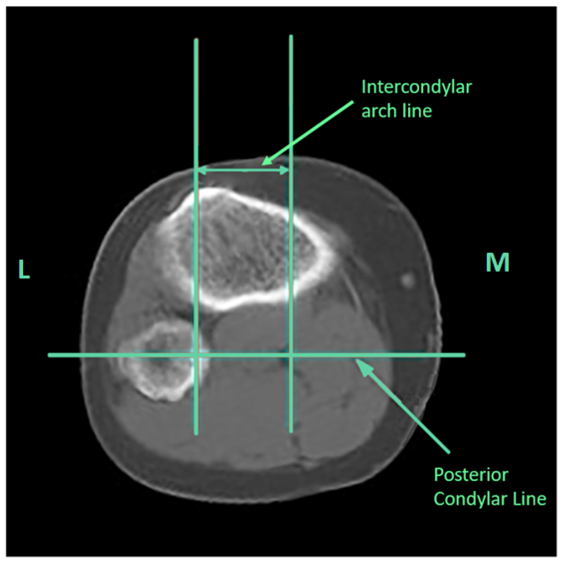 Medicina 60 01570 g003