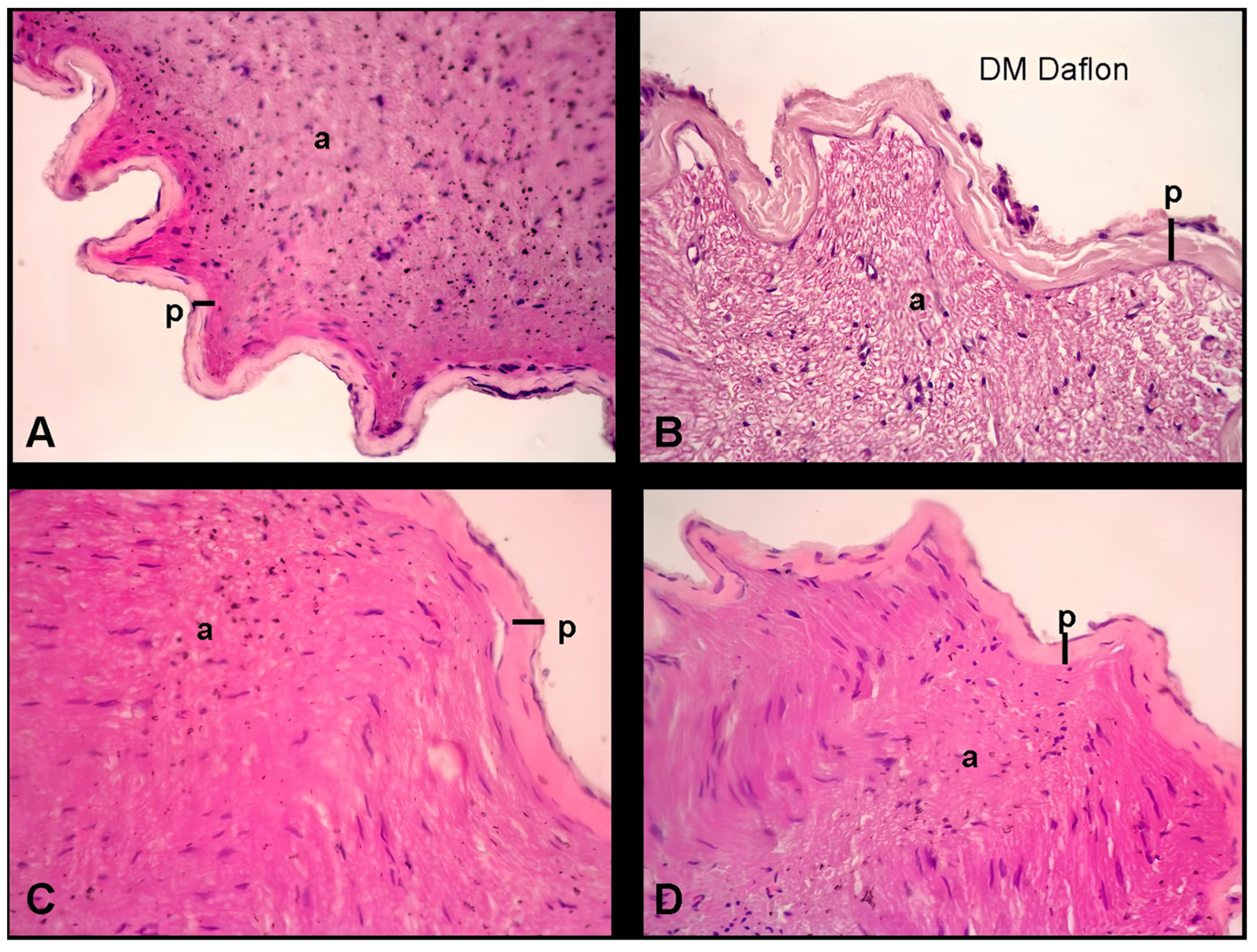 Medicina 60 01580 g004
