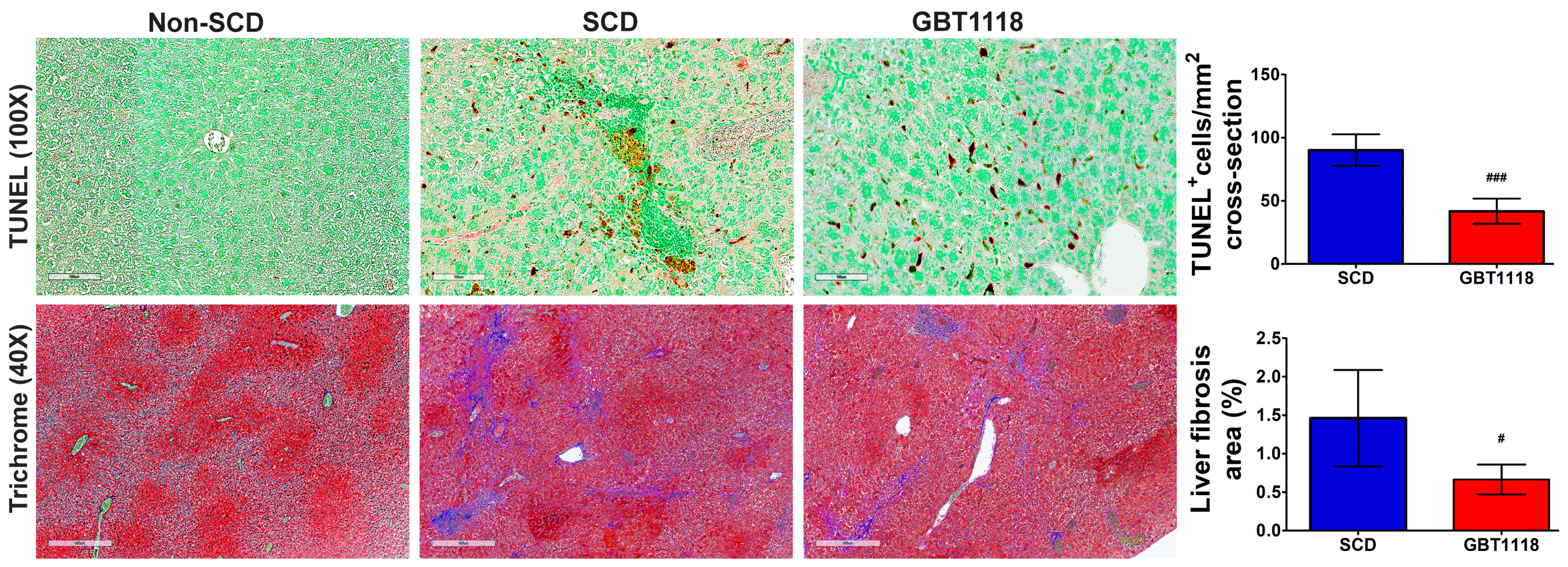 Medicina 60 01581 g006