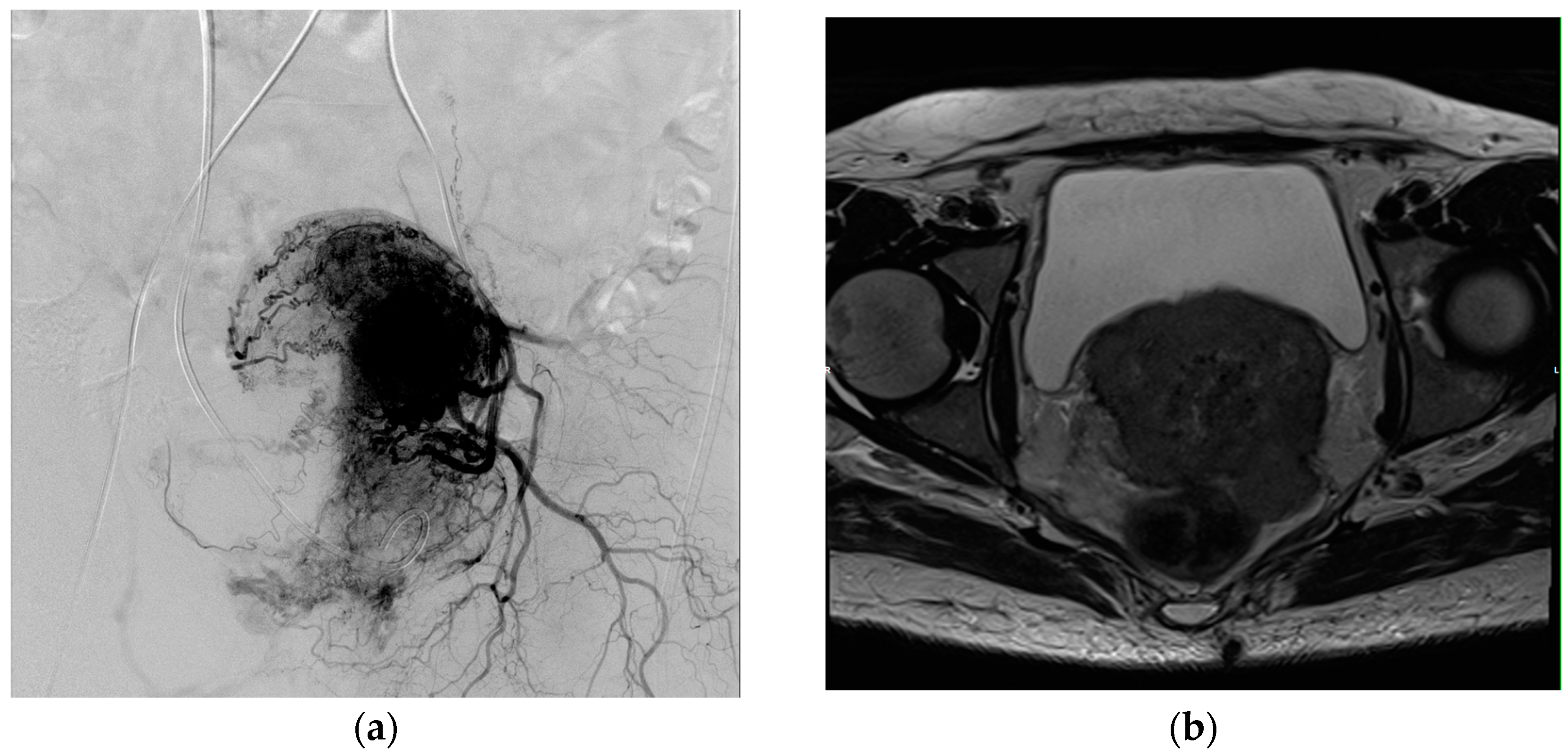 Medicina 60 01585 g001