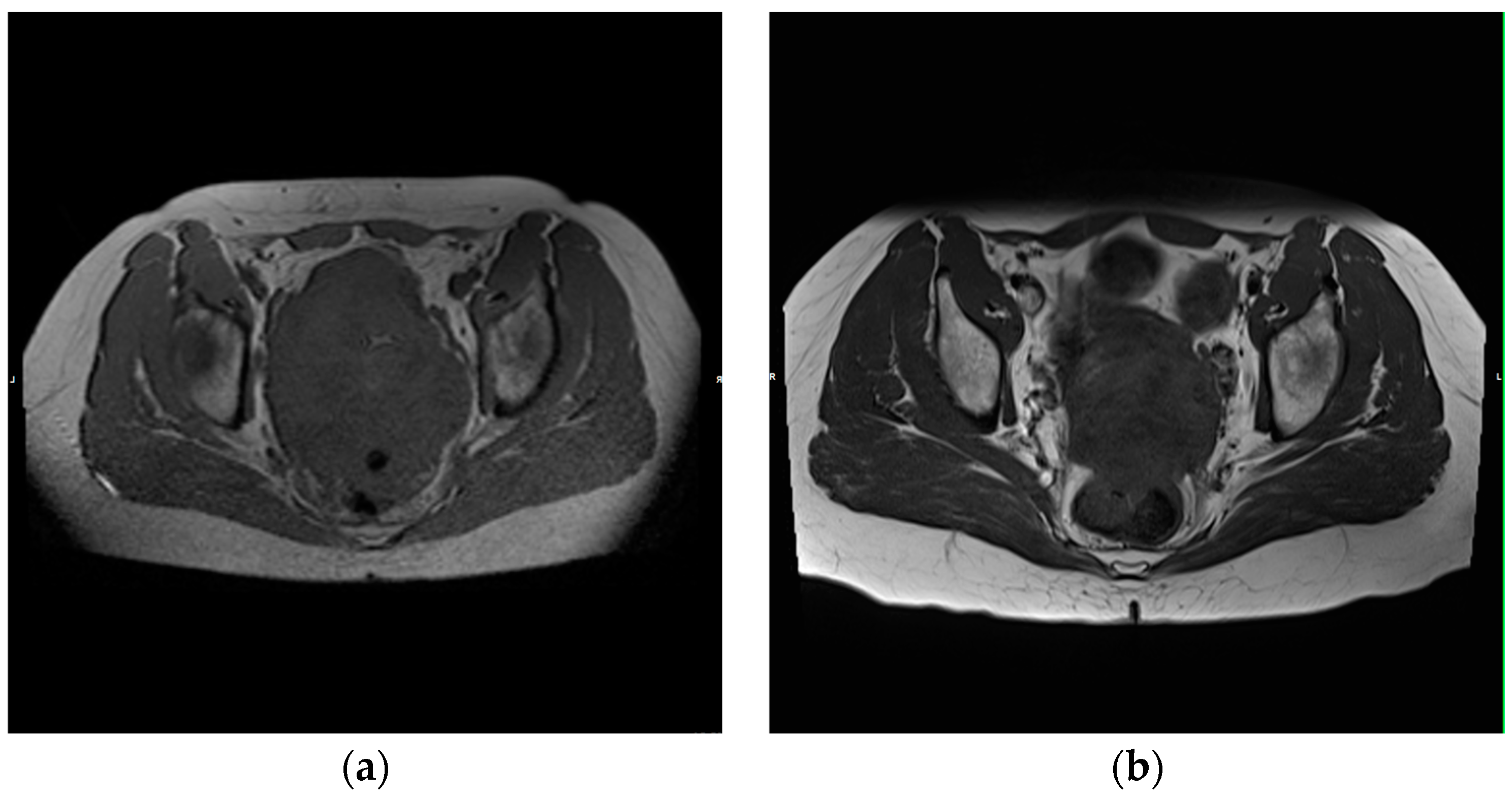 Medicina 60 01585 g003
