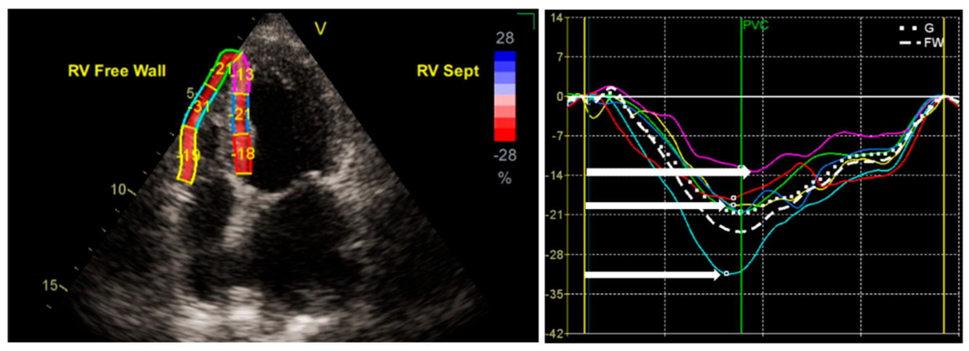 Medicina 60 01586 g003