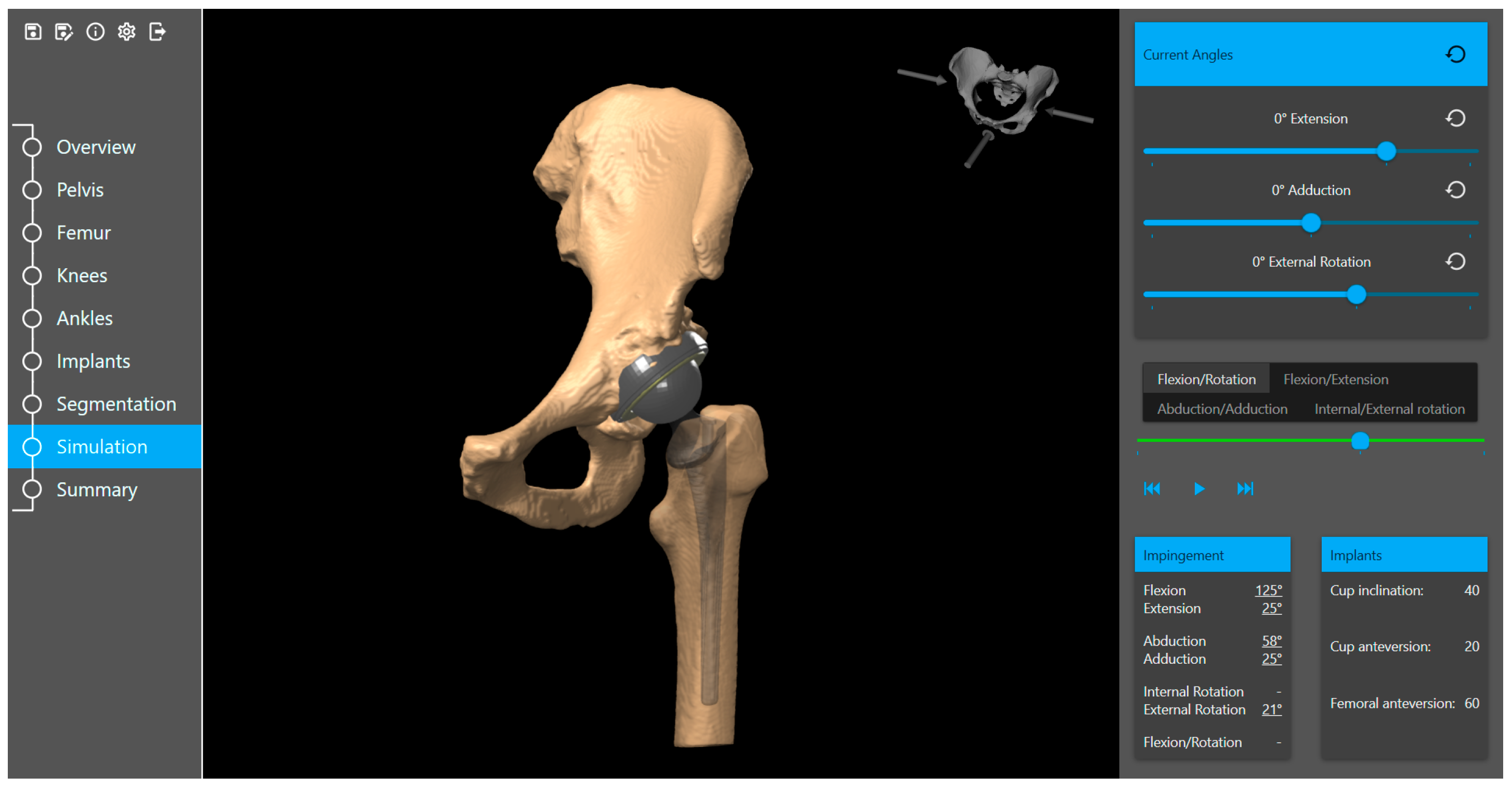 Medicina 60 01589 g004