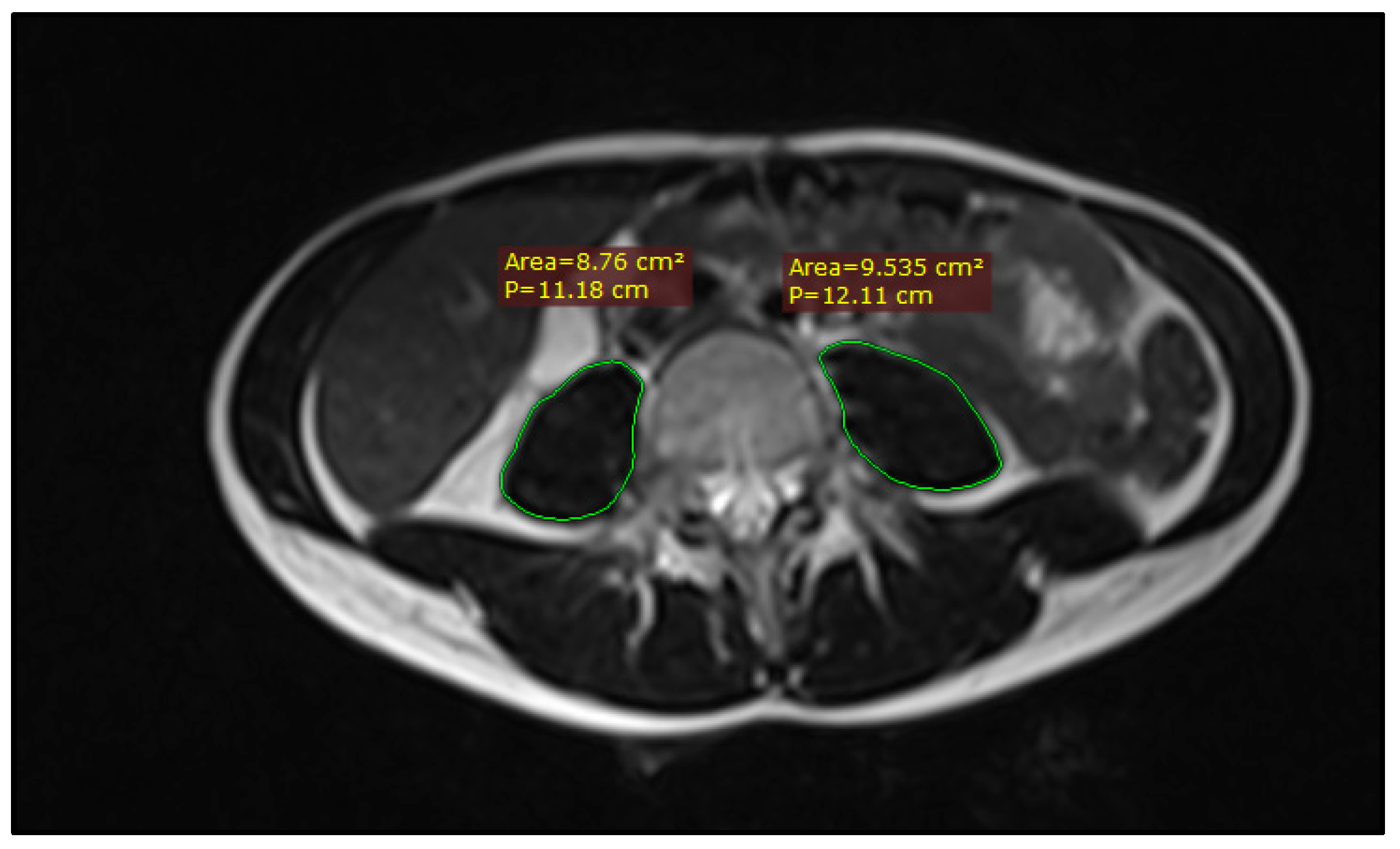 Medicina 60 01606 g001