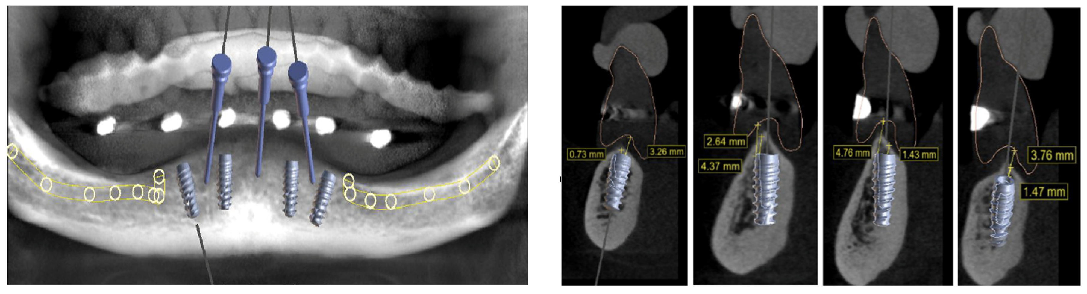 Medicina 60 01614 g003
