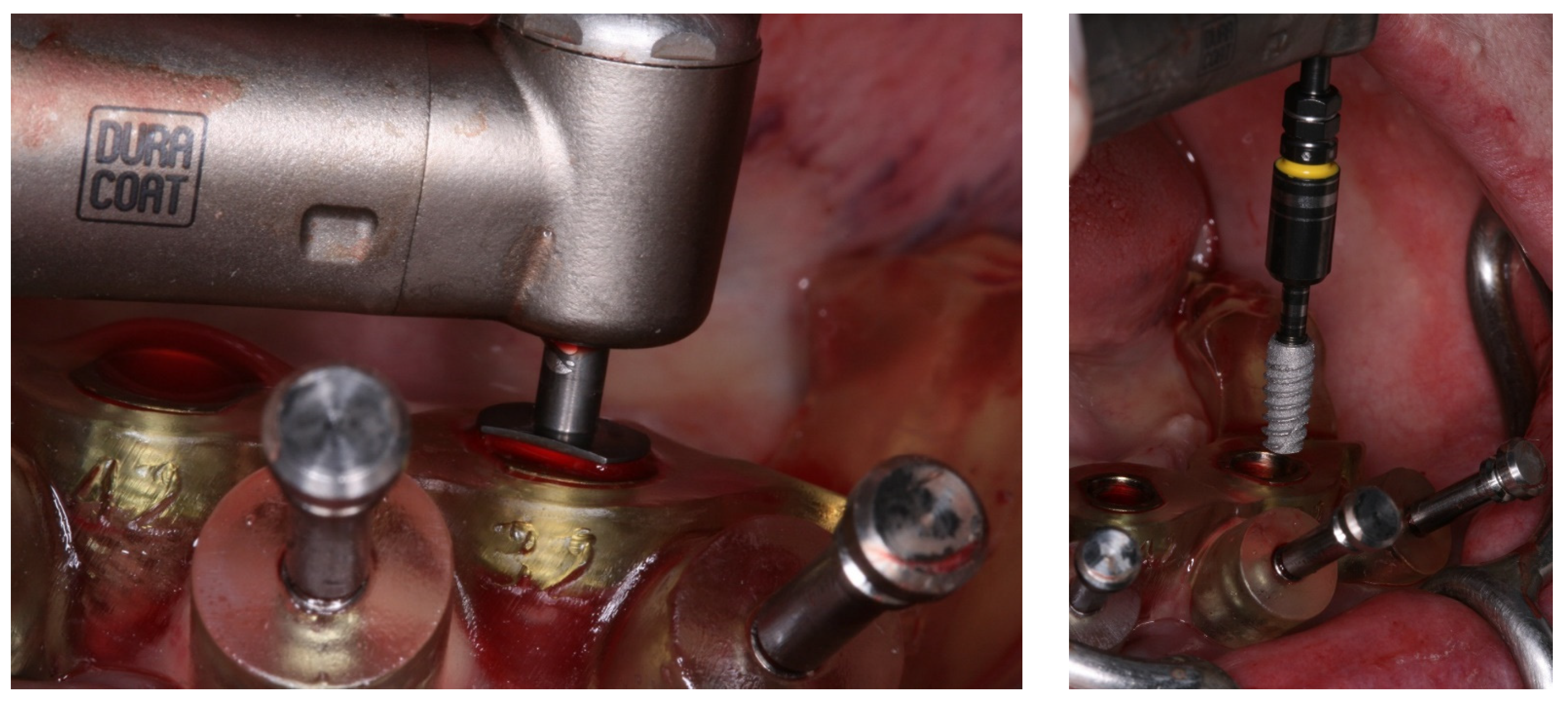 Medicina 60 01614 g006