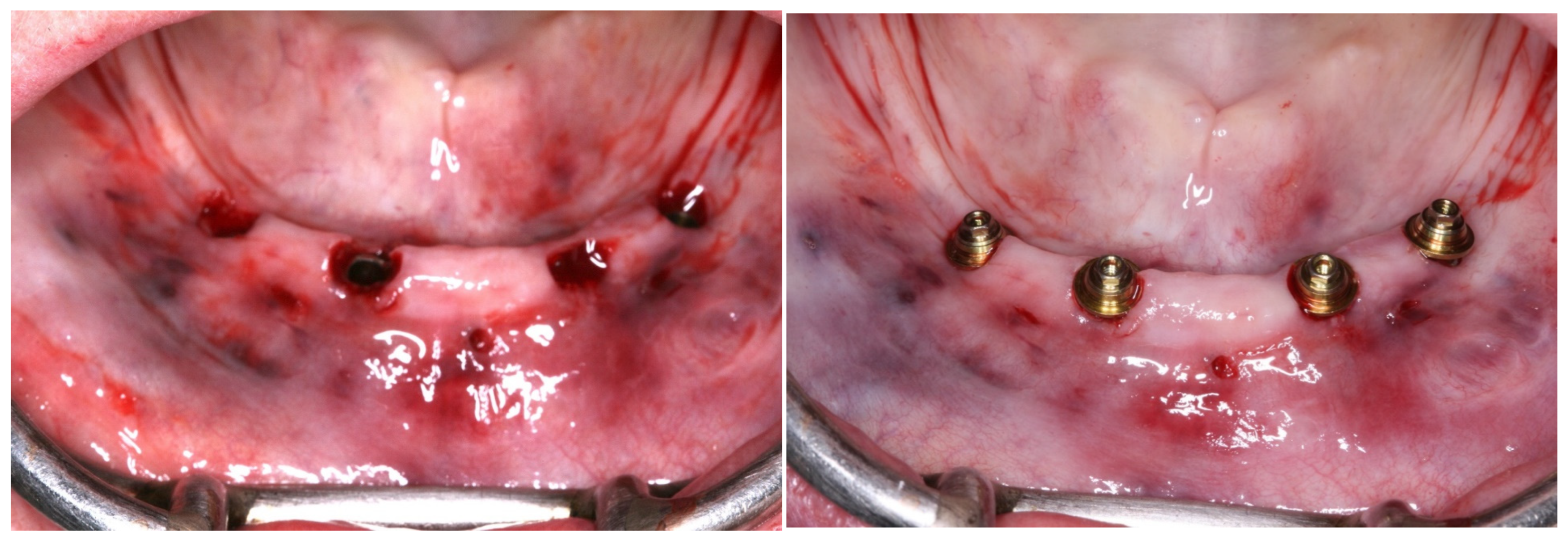 Medicina 60 01614 g007