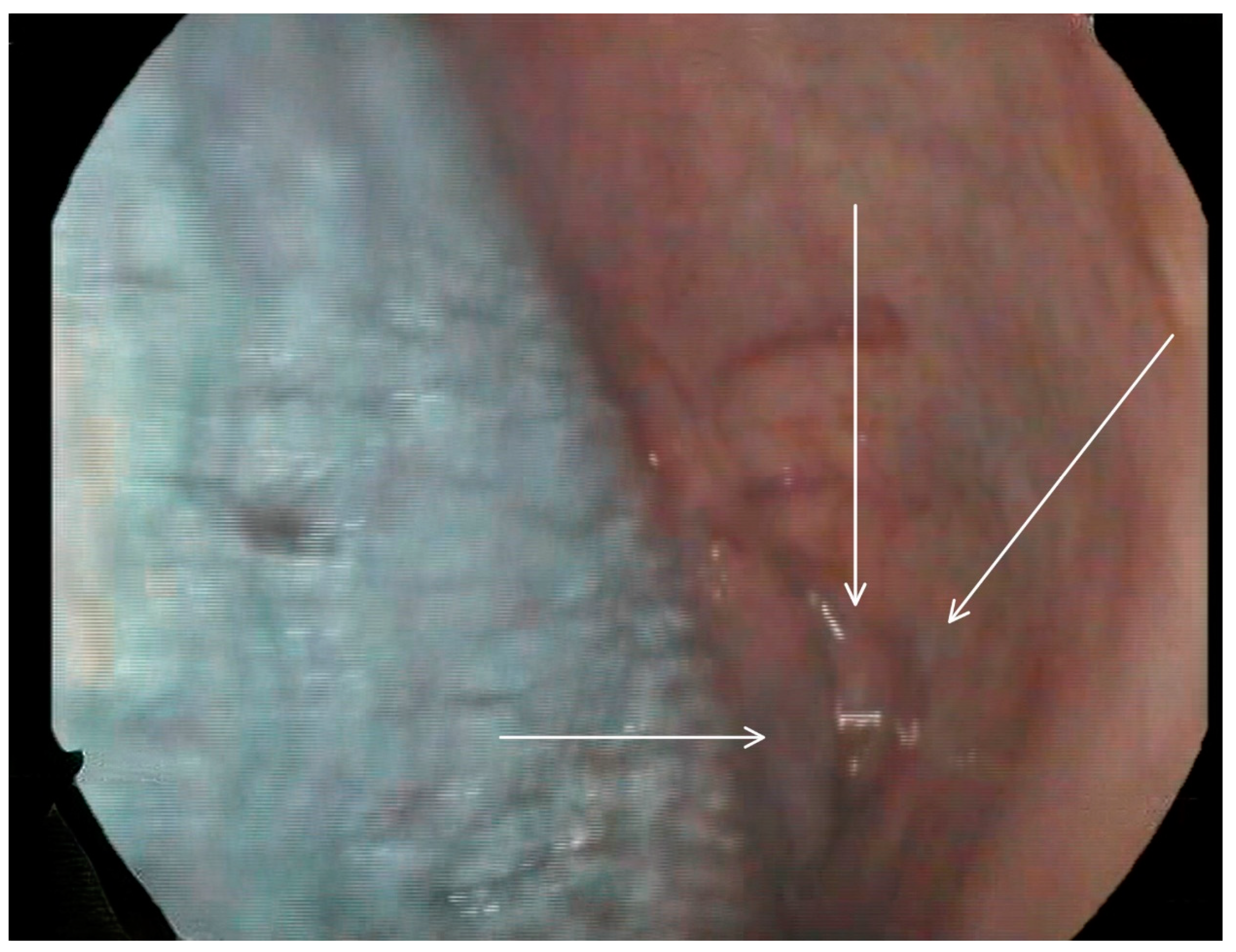 Medicina 60 01628 g003